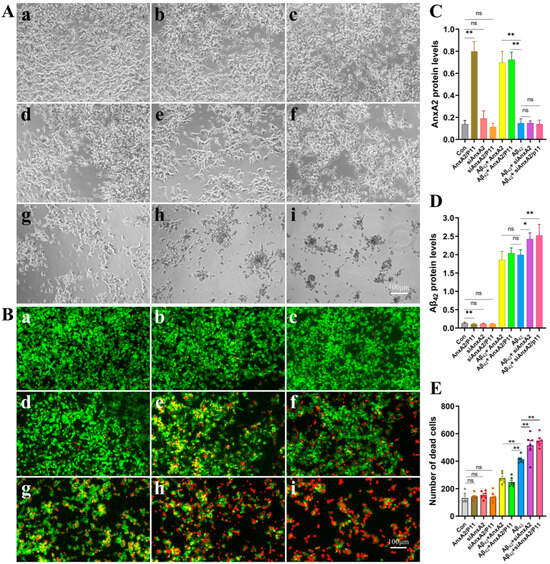 Integrative Human Genetic and Cellular Analysis of the