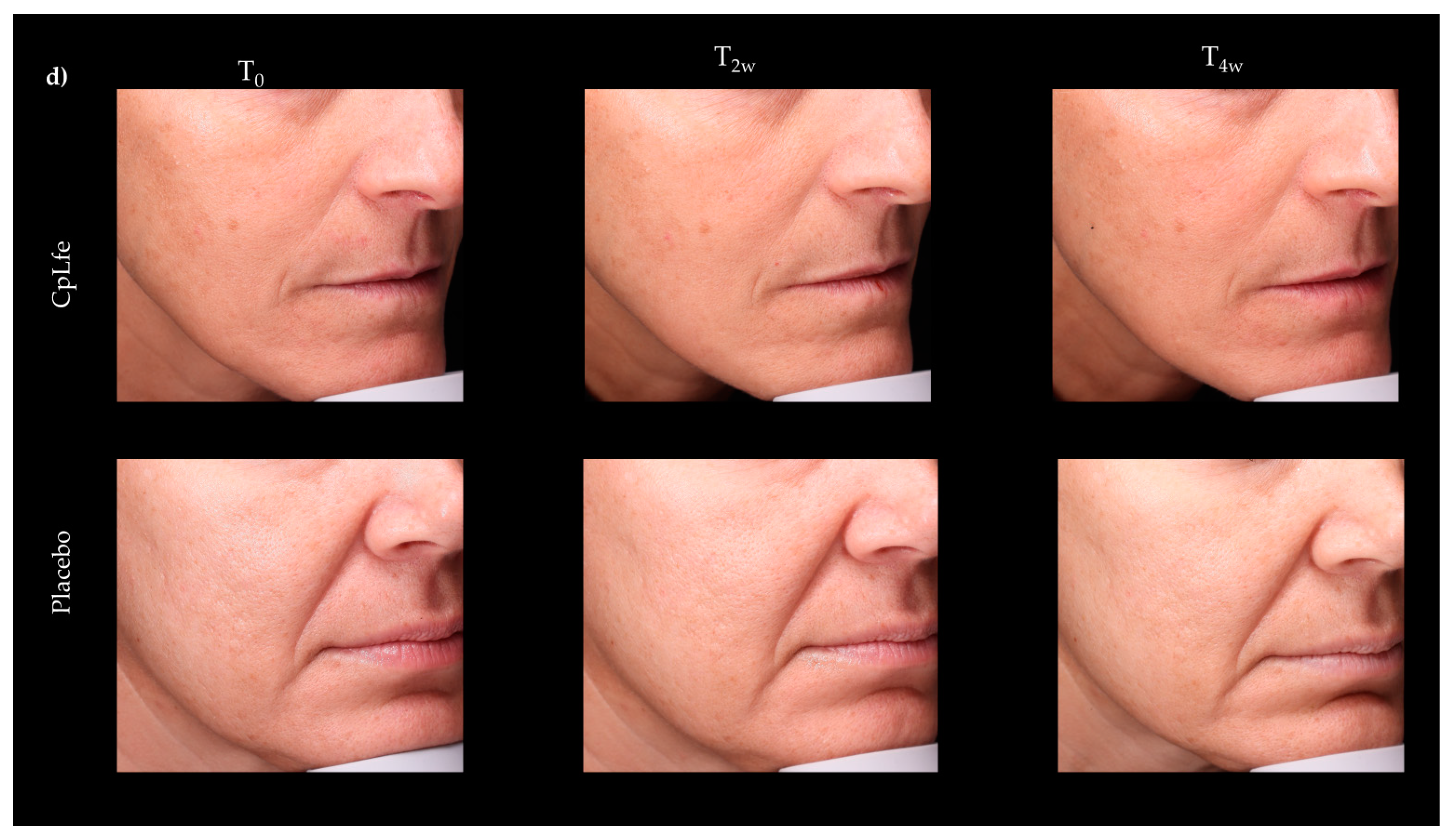 Antioxidants 13 01476 g005b