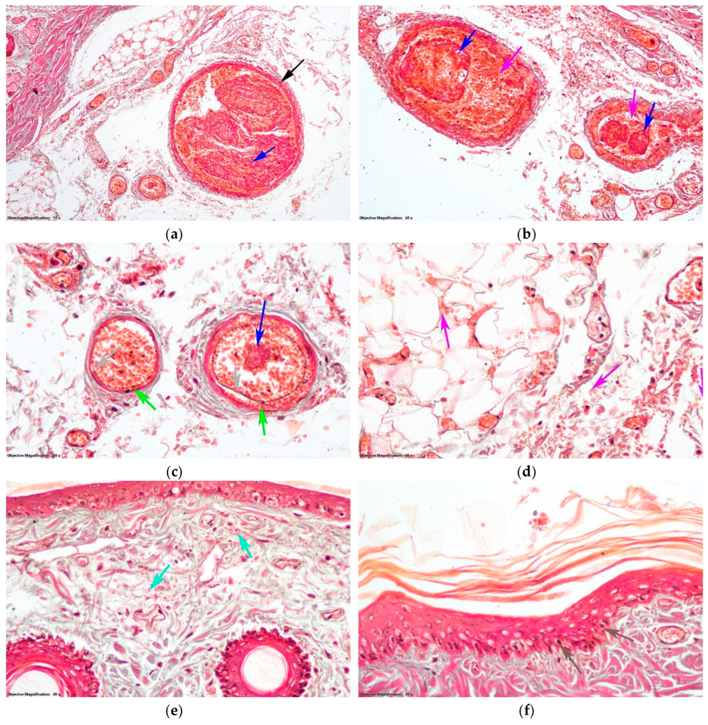 Antioxidants 14 00166 g008