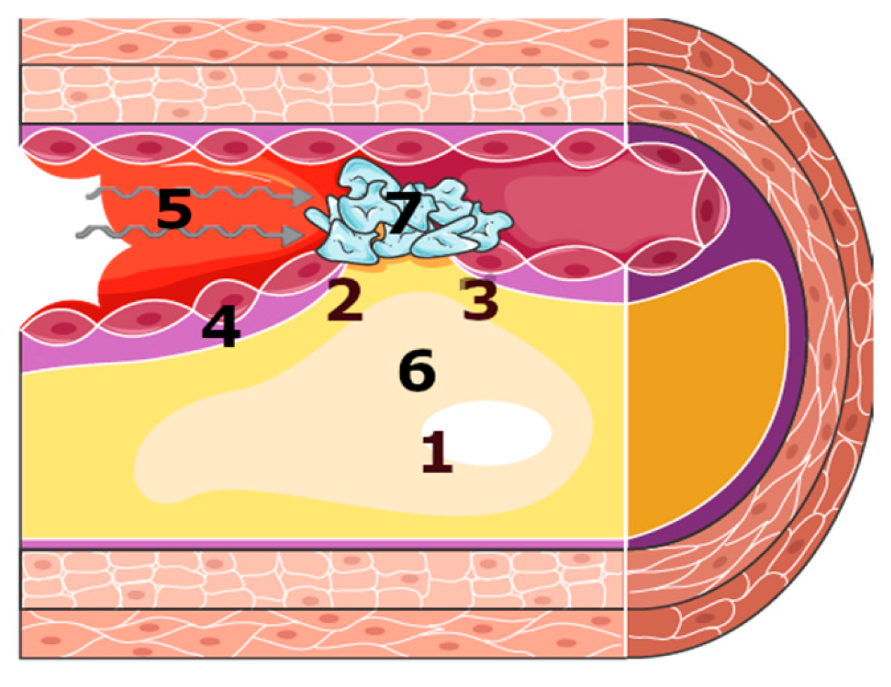 Antioxidants 14 00275 g006 Antioxidants 14 00275 g006