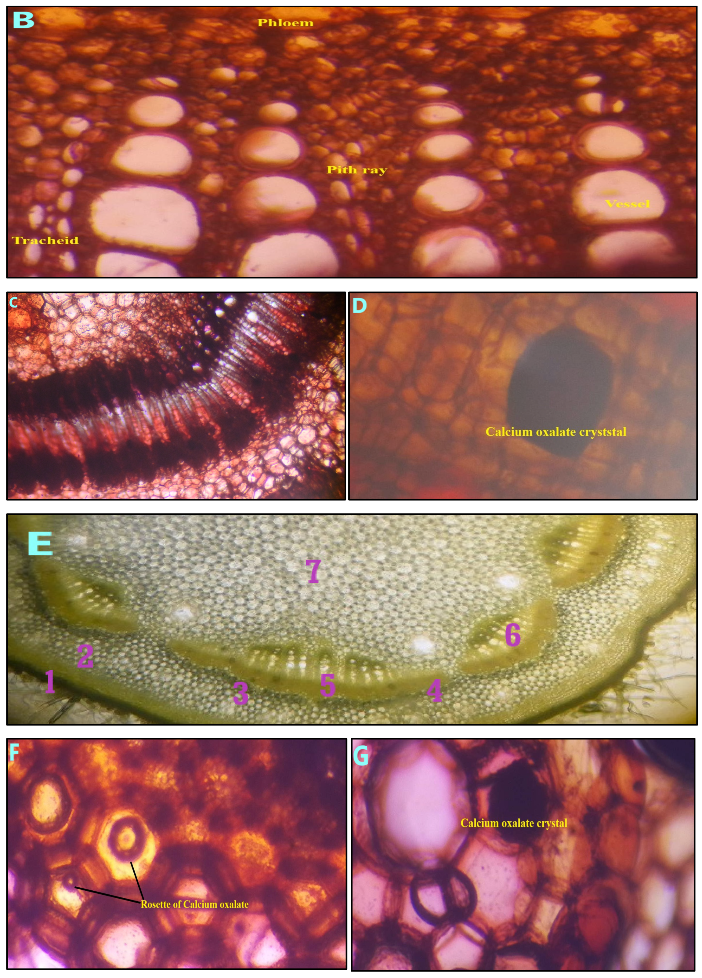 Antioxidants 14 00472 g003b
