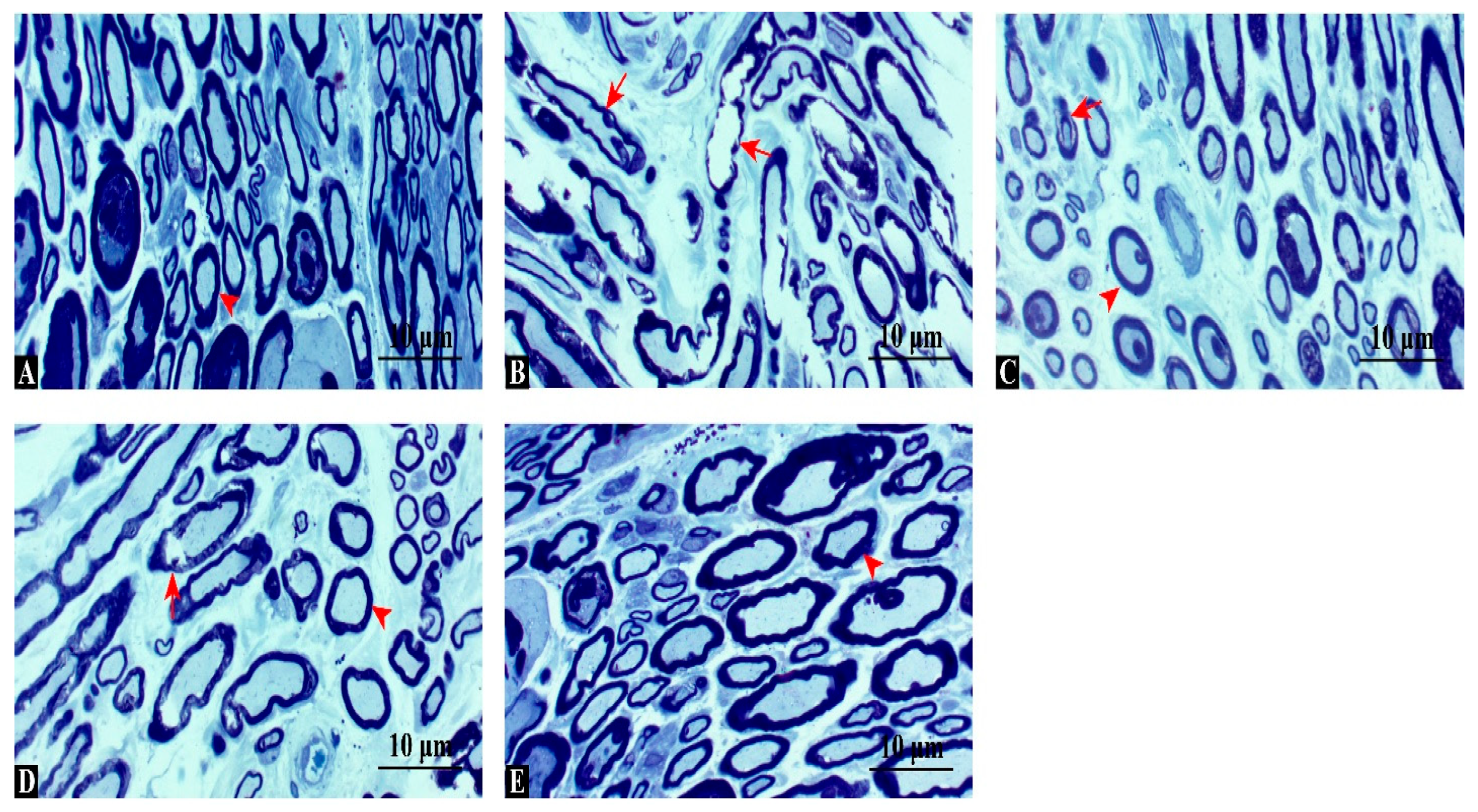 Antioxidants 14 01382 g003