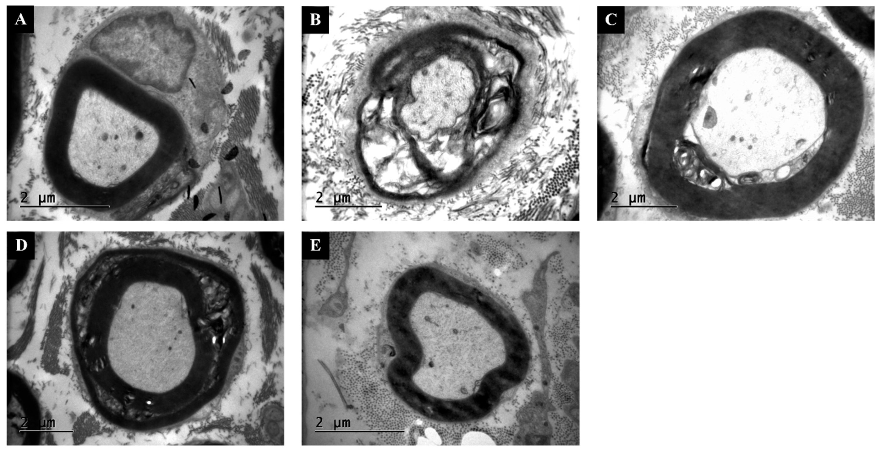 Antioxidants 14 01382 g005