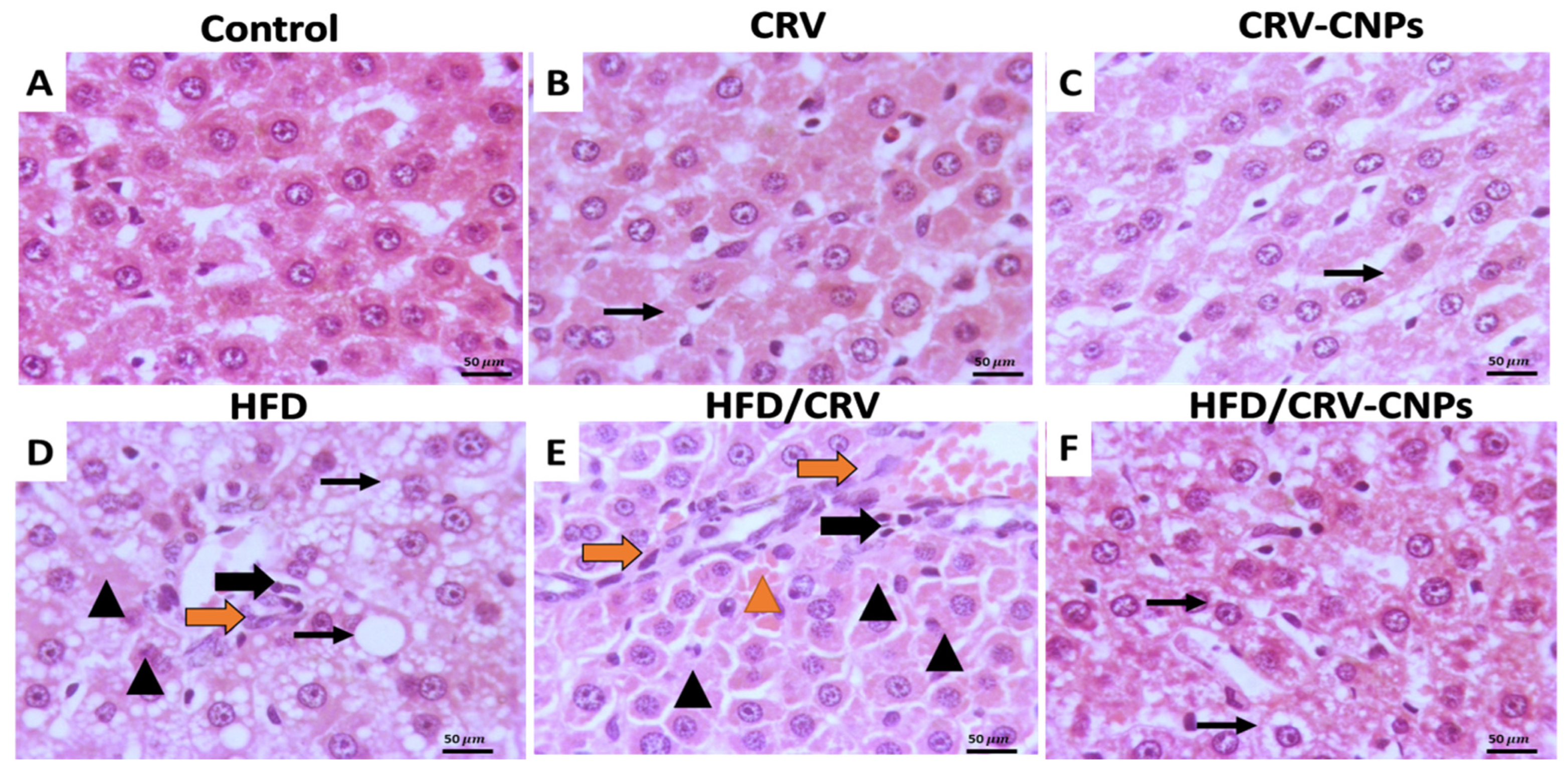 Antioxidants 14 01432 g012