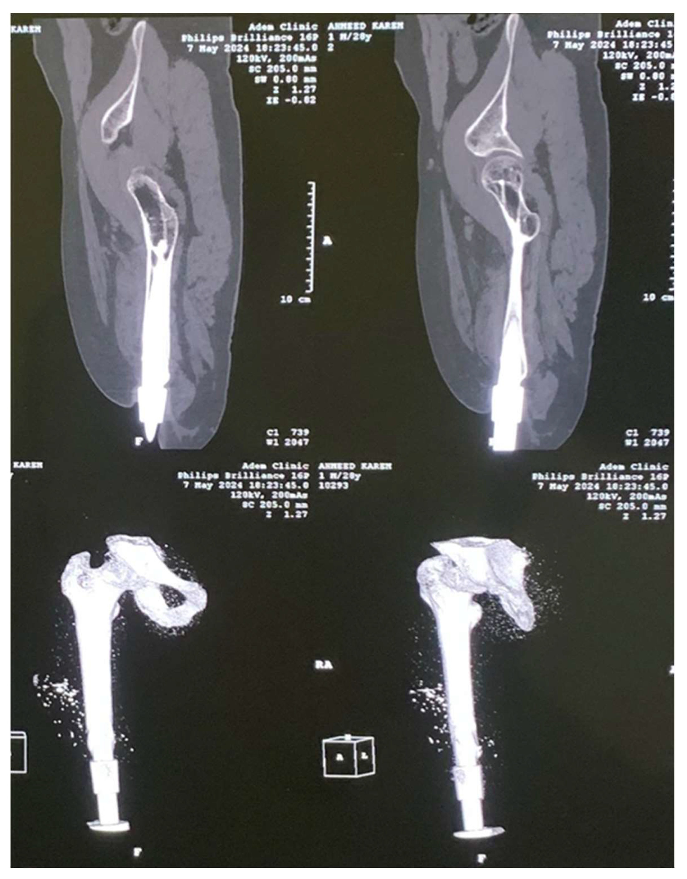 Applmech 06 00077 g003 Applmech 06 00077 g003