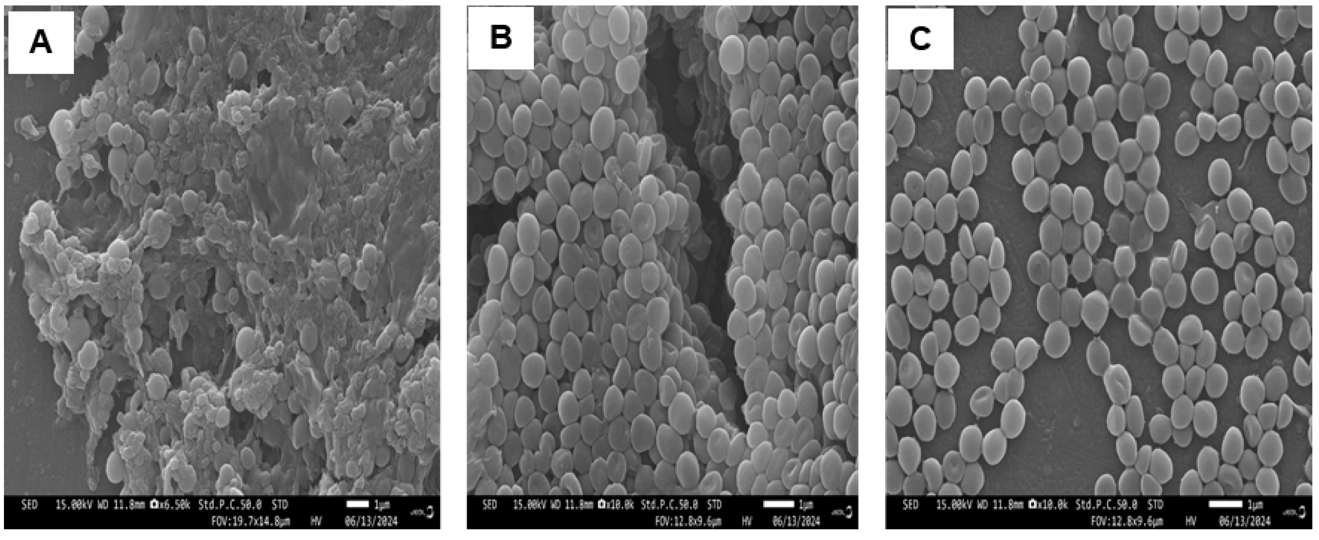 Applmicrobiol 05 00032 g006 Applmicrobiol 05 00032 g006