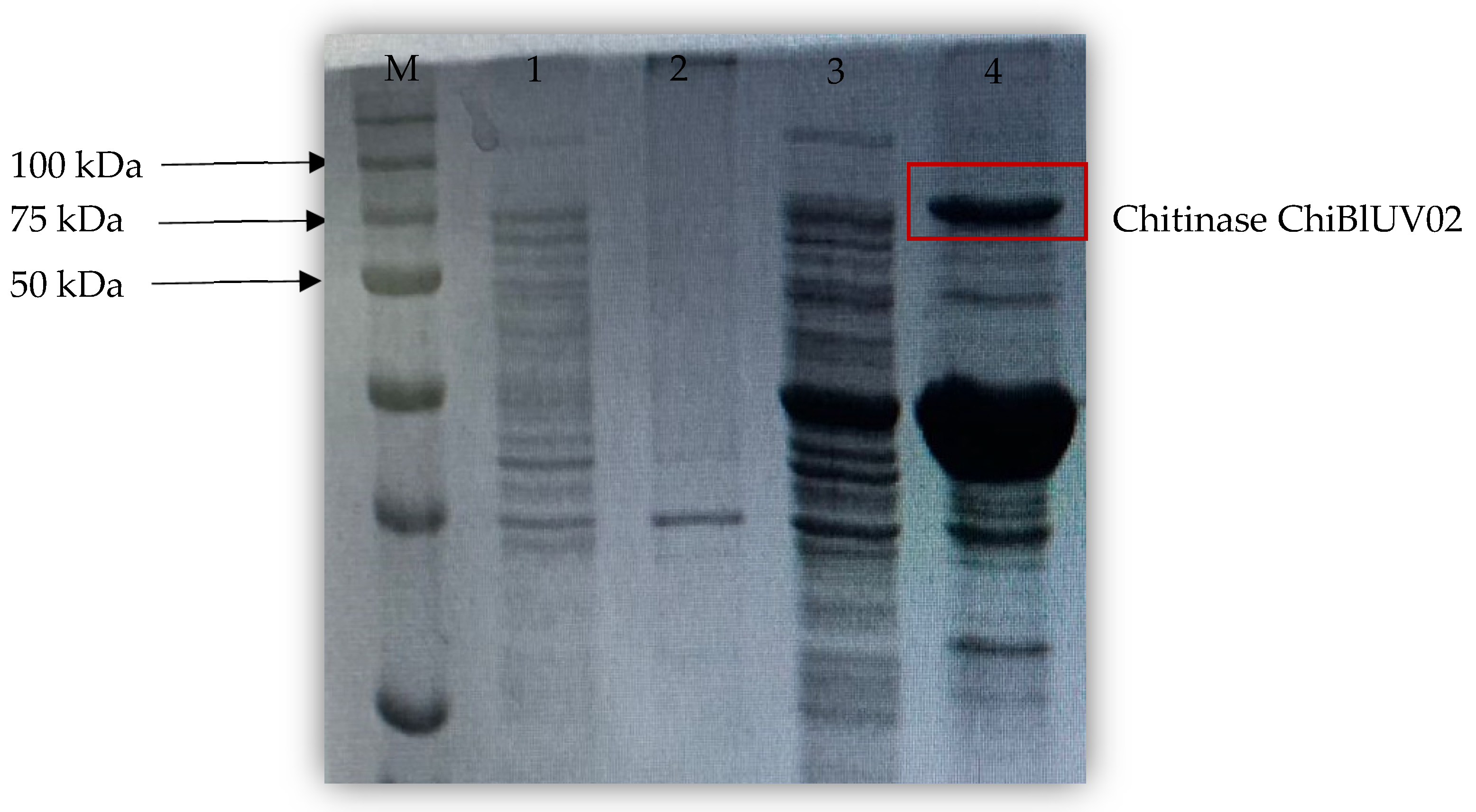 Applmicrobiol 05 00048 g003
