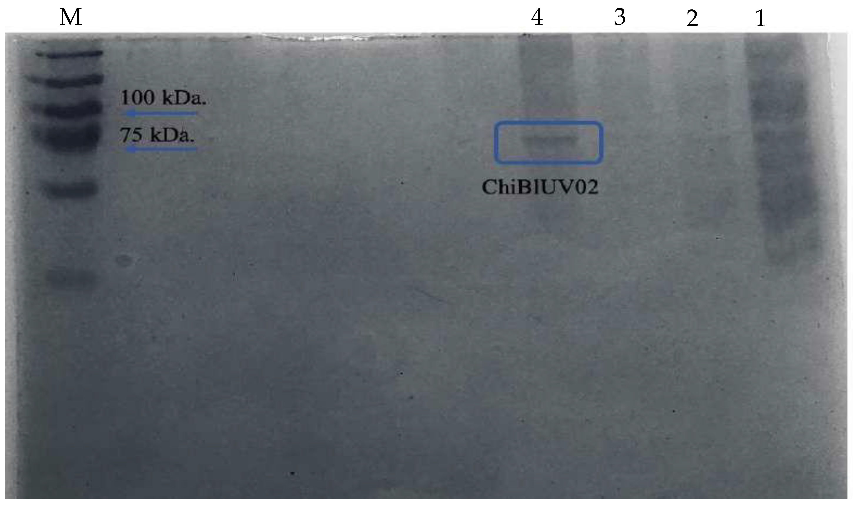 Applmicrobiol 05 00048 g006
