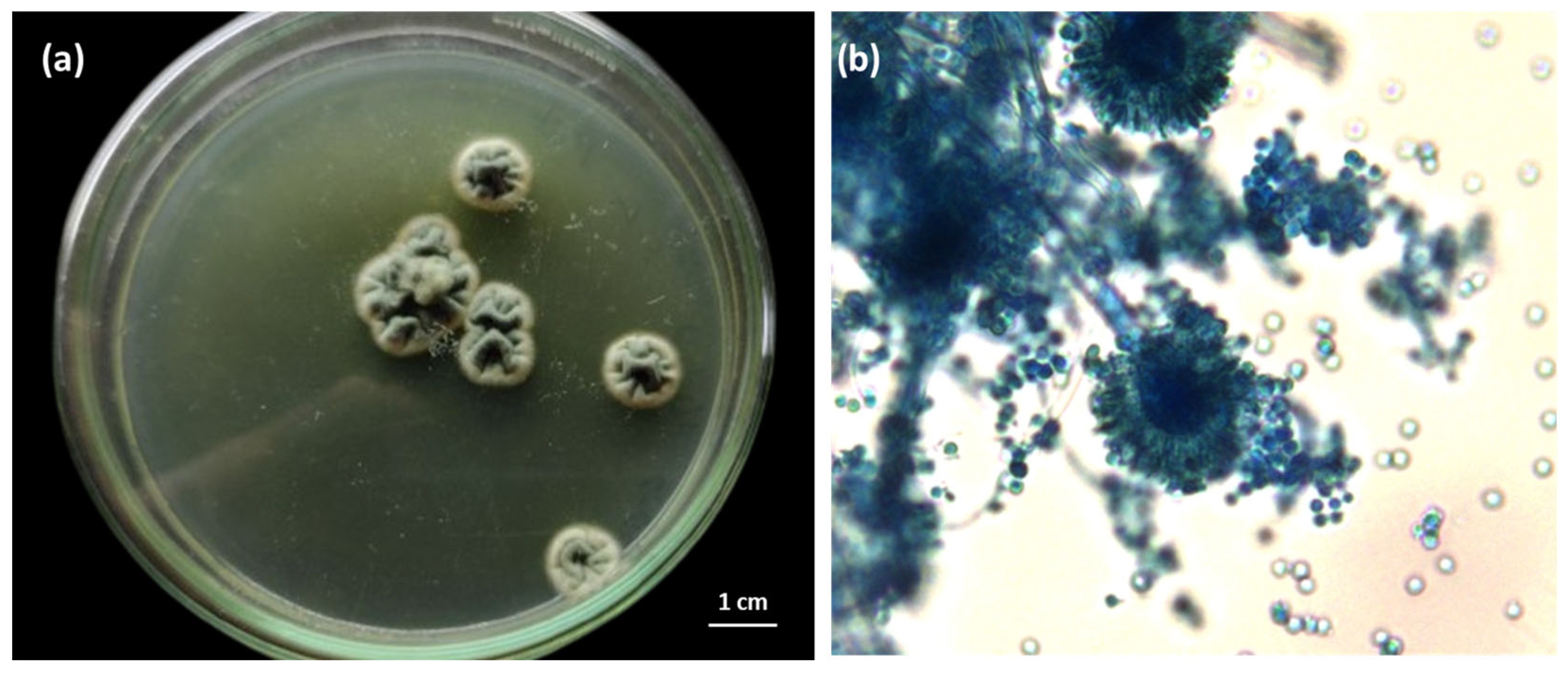 Applmicrobiol 05 00071 g003