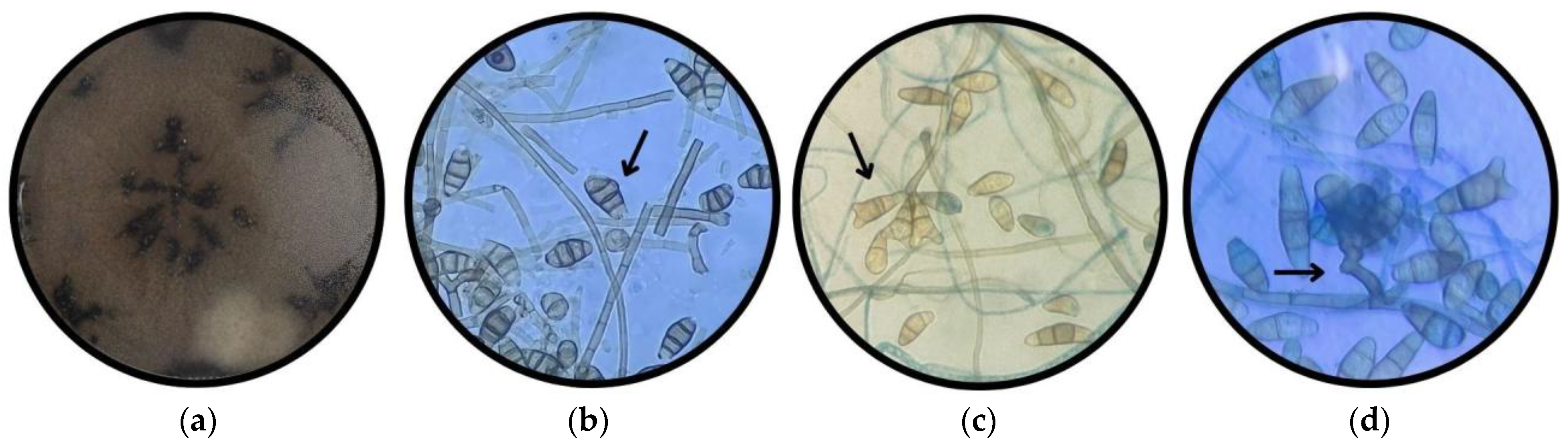 Applmicrobiol 05 00114 g002 Applmicrobiol 05 00114 g002