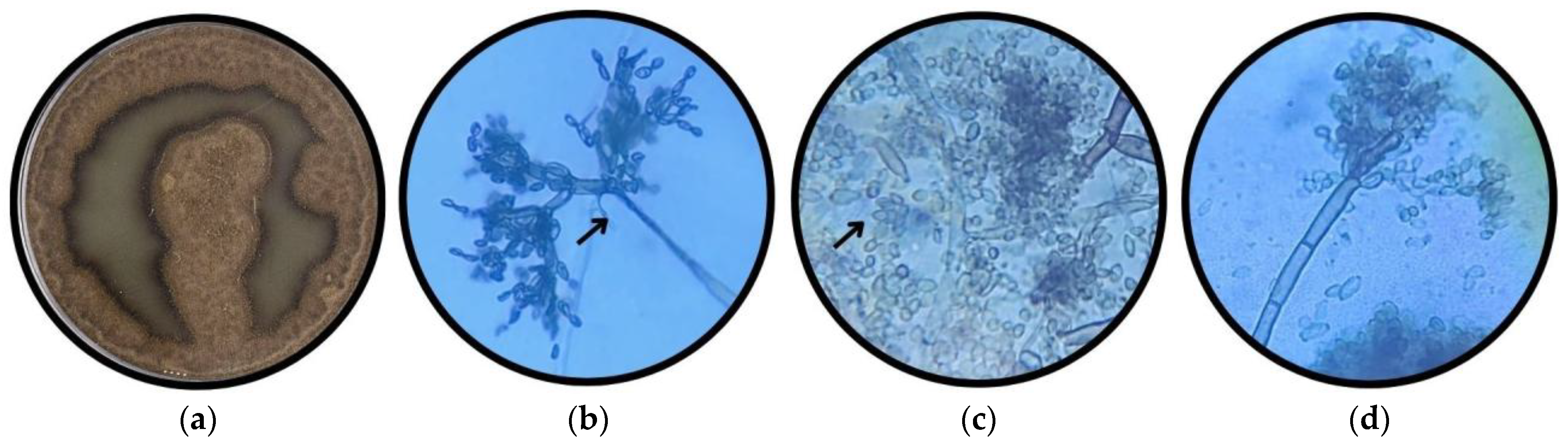 Applmicrobiol 05 00114 g004 Applmicrobiol 05 00114 g004