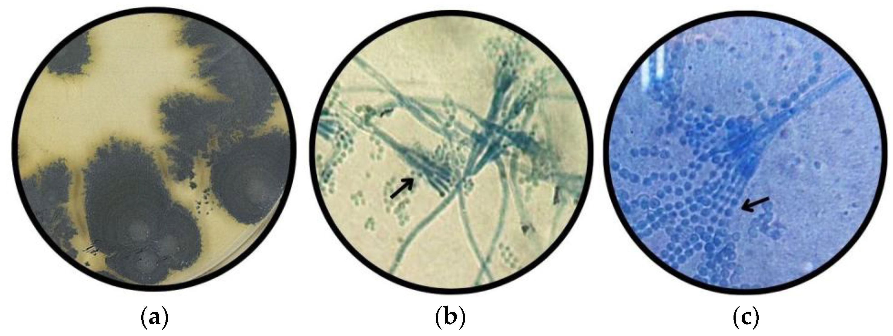 Applmicrobiol 05 00114 g005 Applmicrobiol 05 00114 g005
