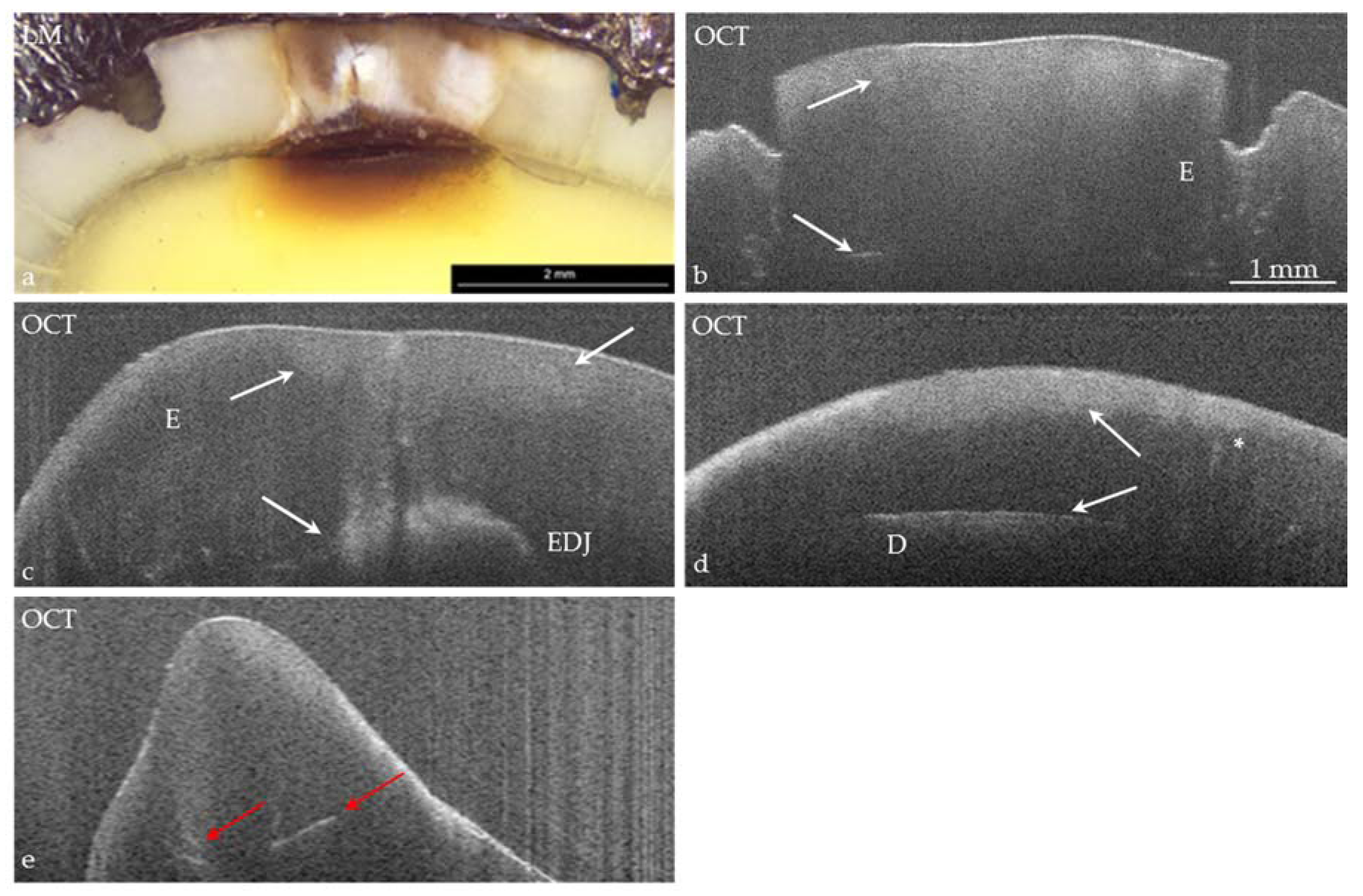 Applied Sciences Free FullText Dental Applications of Optical