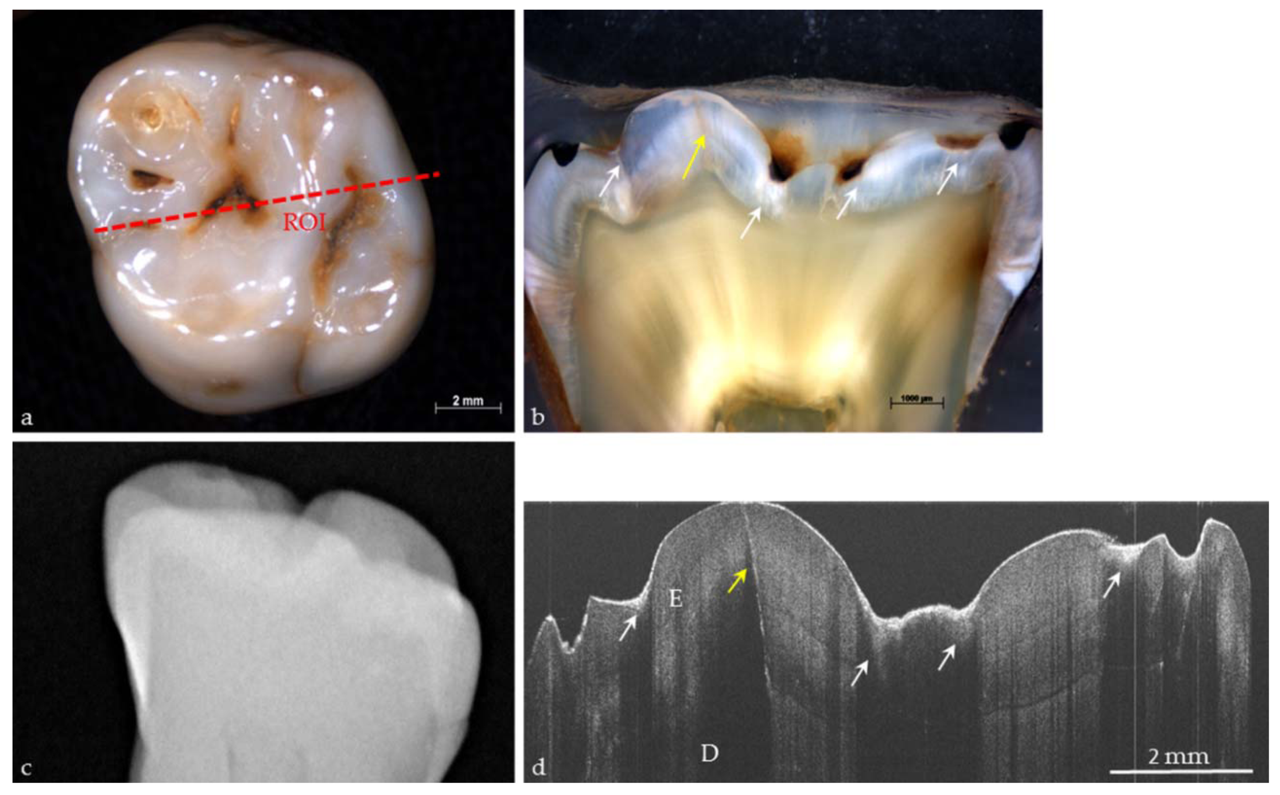 Applied Sciences Free FullText Dental Applications of Optical