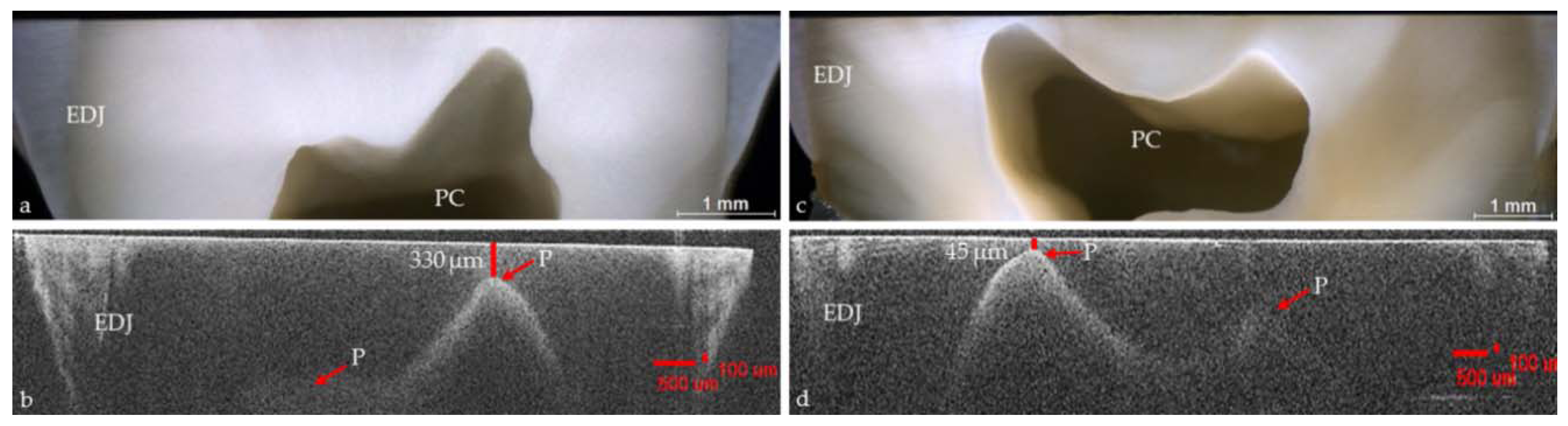 Applied Sciences Free FullText Dental Applications of Optical
