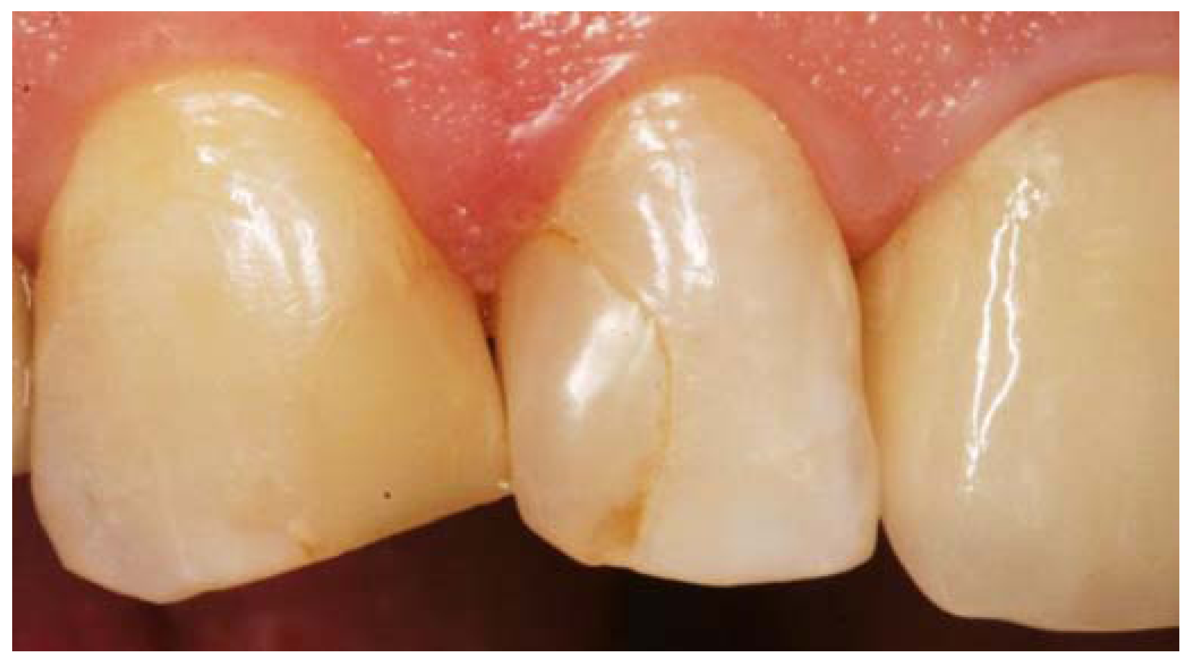 Applied Sciences Free FullText Dental Applications of Optical