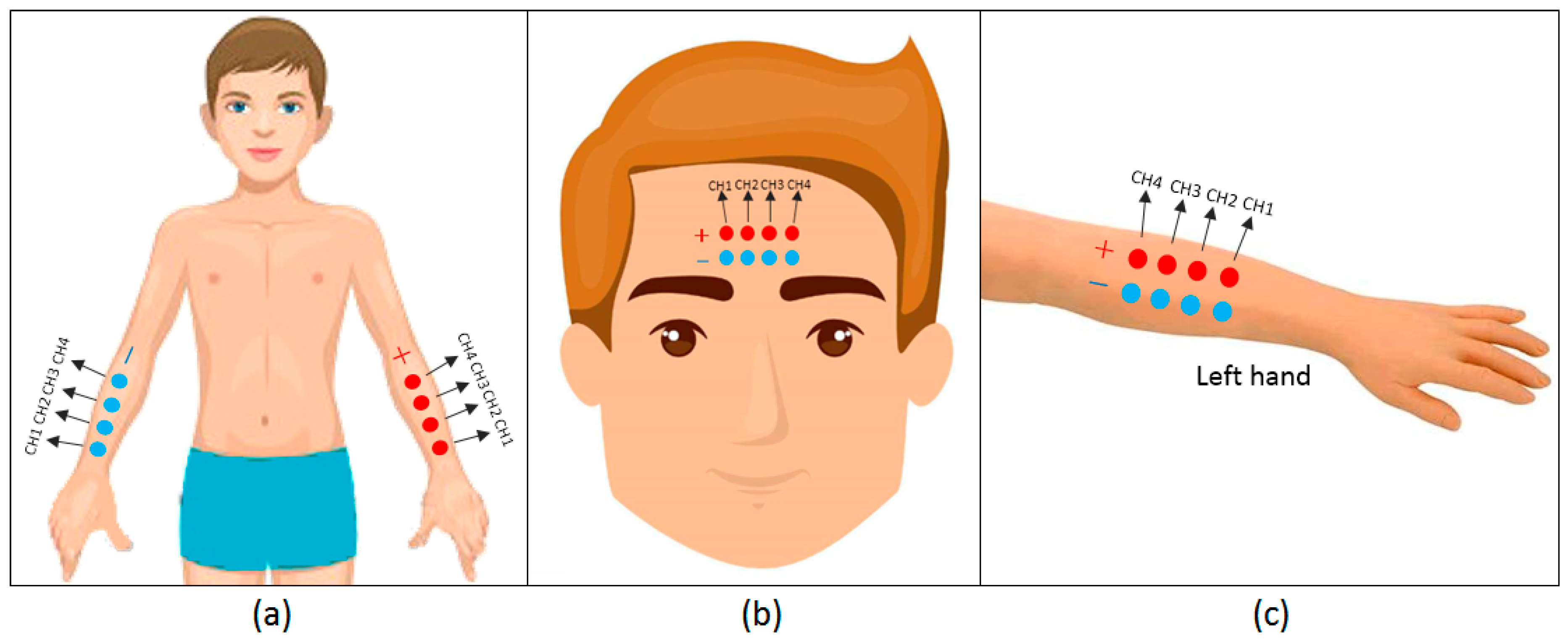 Applsci 08 00276 g004