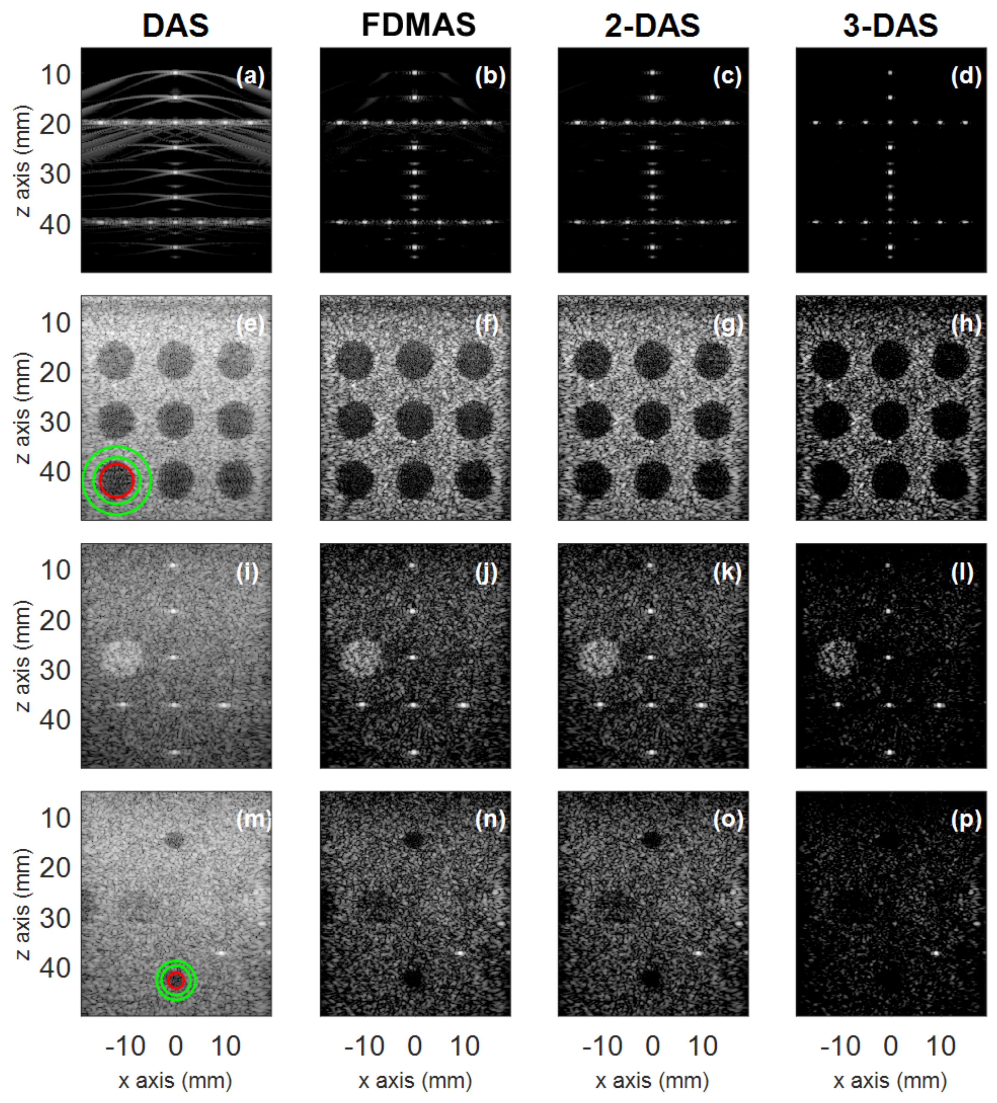 Applied Sciences Free Full Text A Nonlinear Beamformer Based On P Th Root Compression Application To Plane Wave Ultrasound Imaging Html