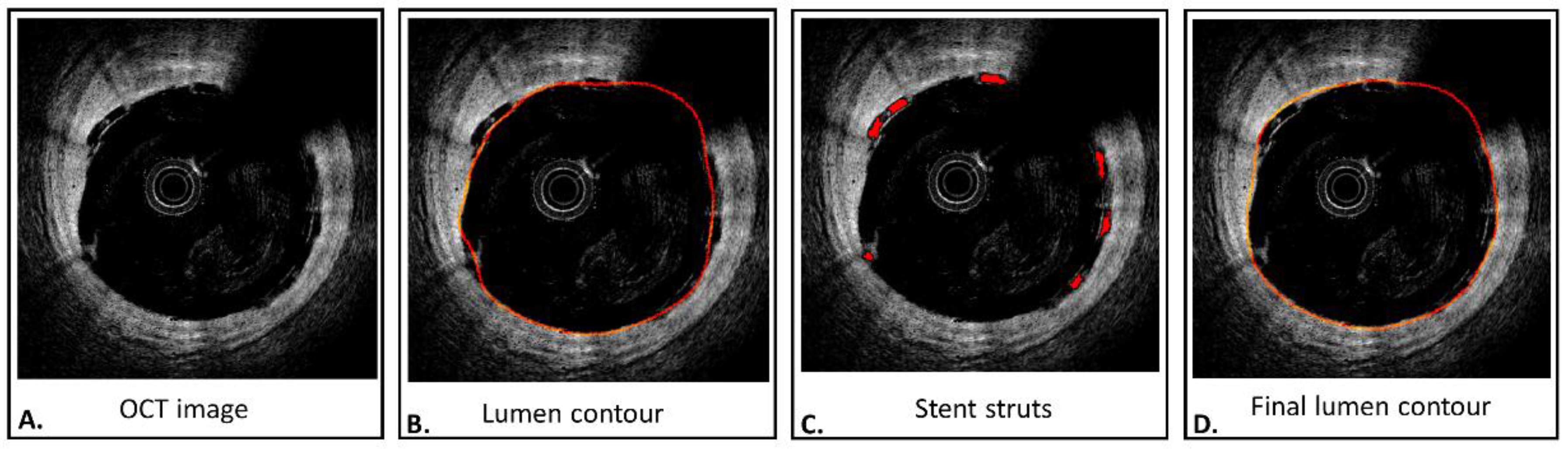 Applsci 08 01510 g001 550