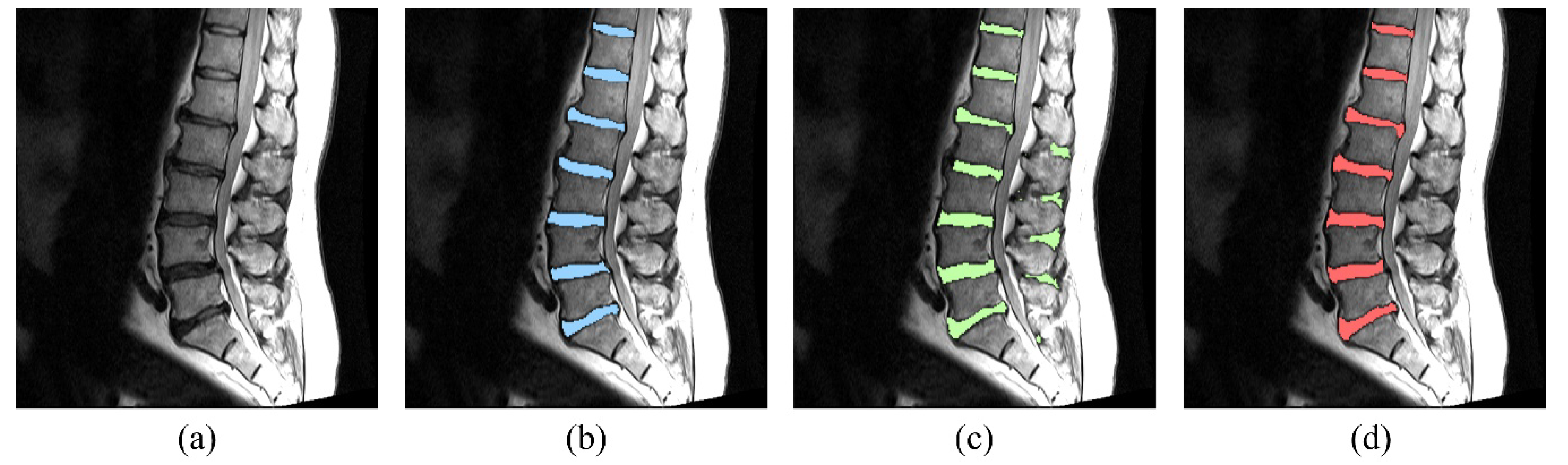 Applsci 08 01656 g007 550