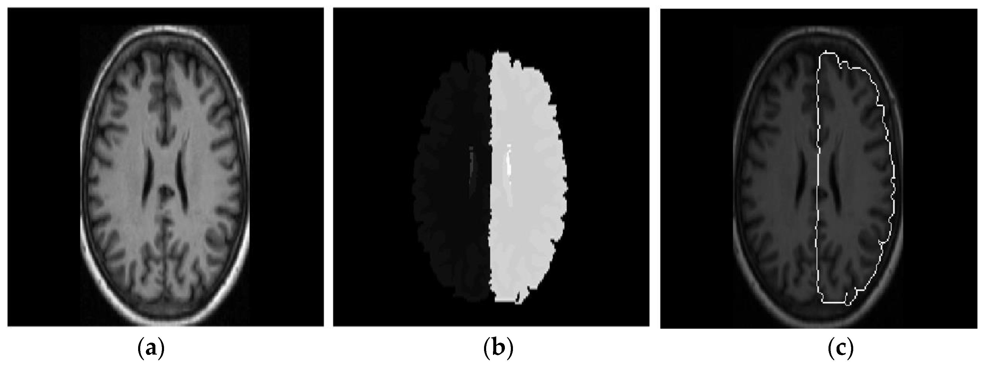 Applsci 08 02203 g013 Applsci 08 02203 g013