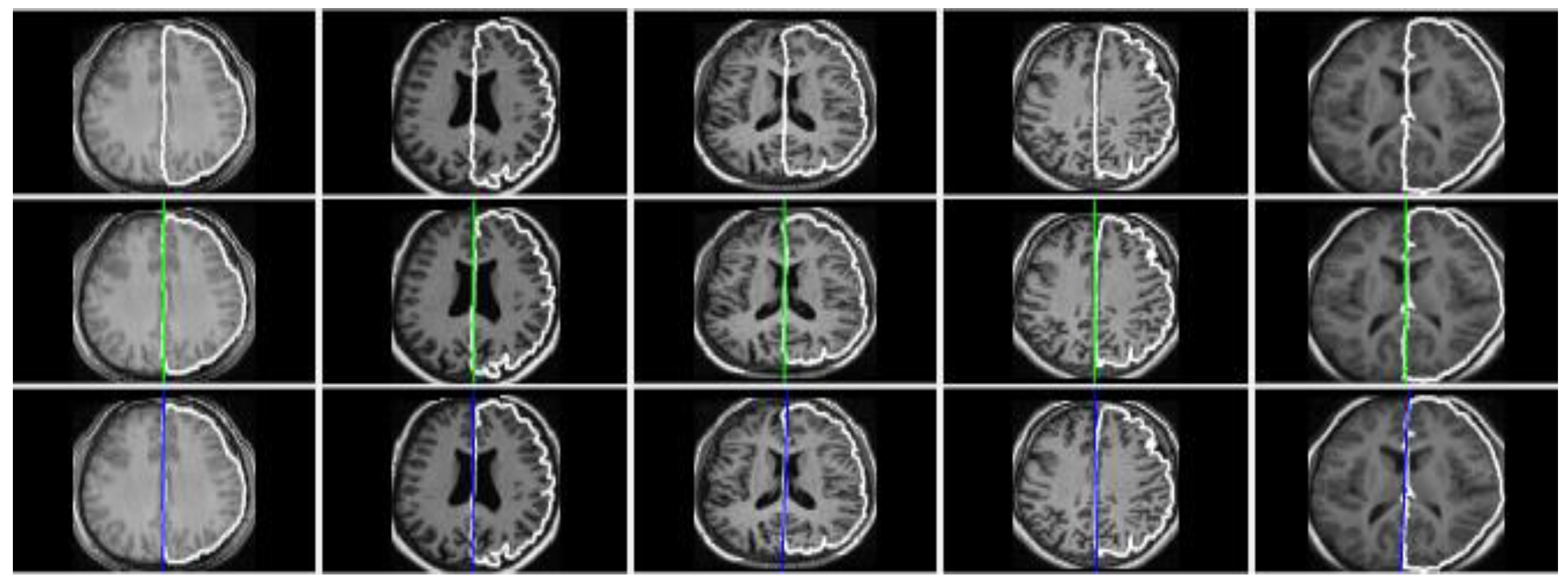 Applsci 08 02203 g014 Applsci 08 02203 g014