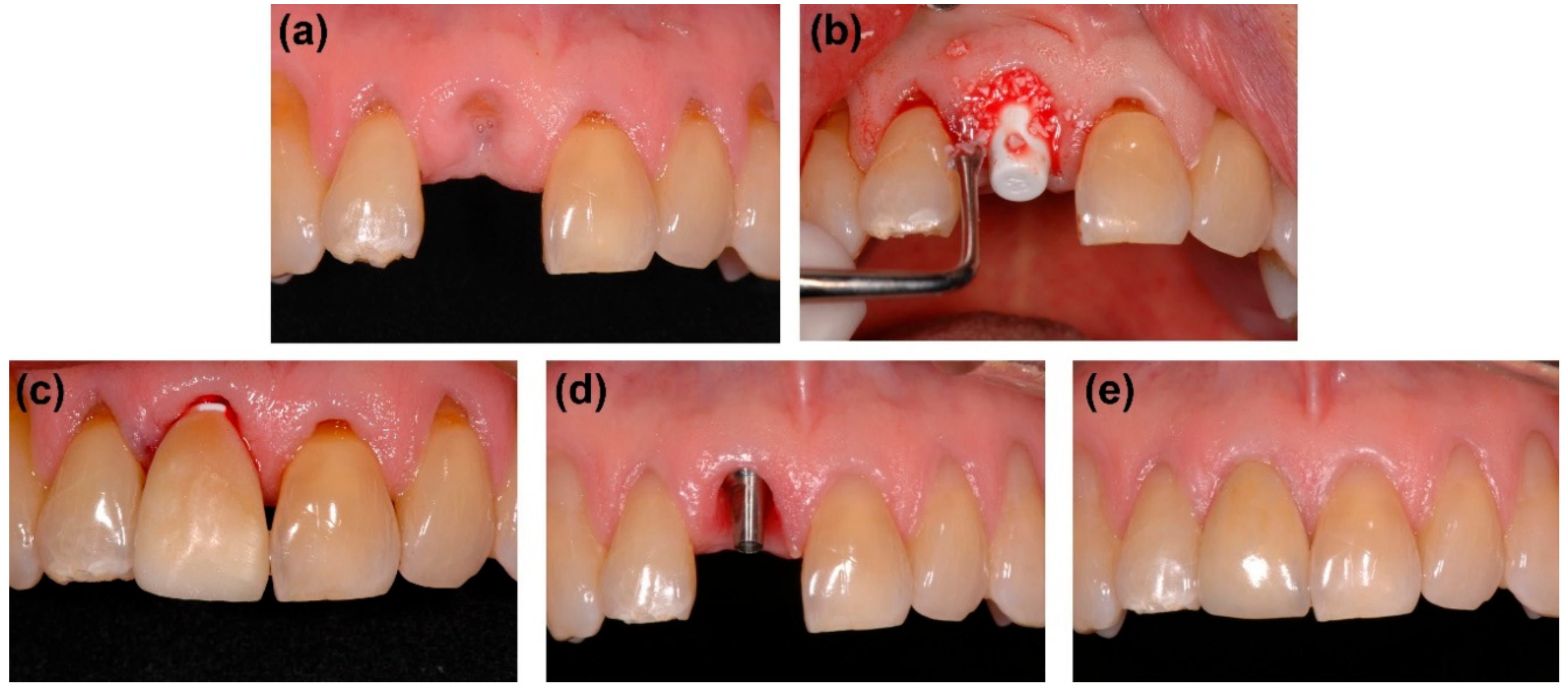 Applsci 08 02261 g002 550
