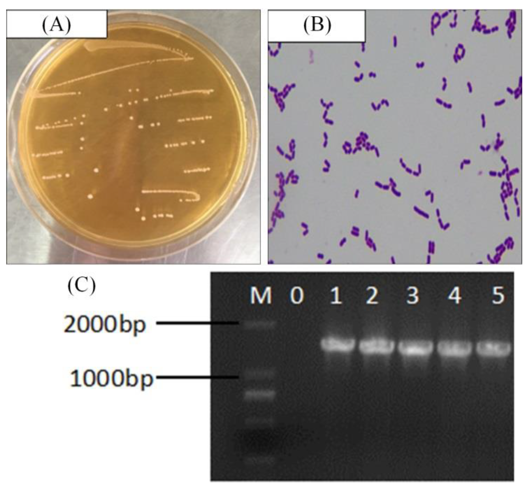 Applied Sciences Free Full Text Lactobacillus Plantarum Cqpc05 Isolated From Pickled Vegetables Inhibits Constipation In Mice Html
