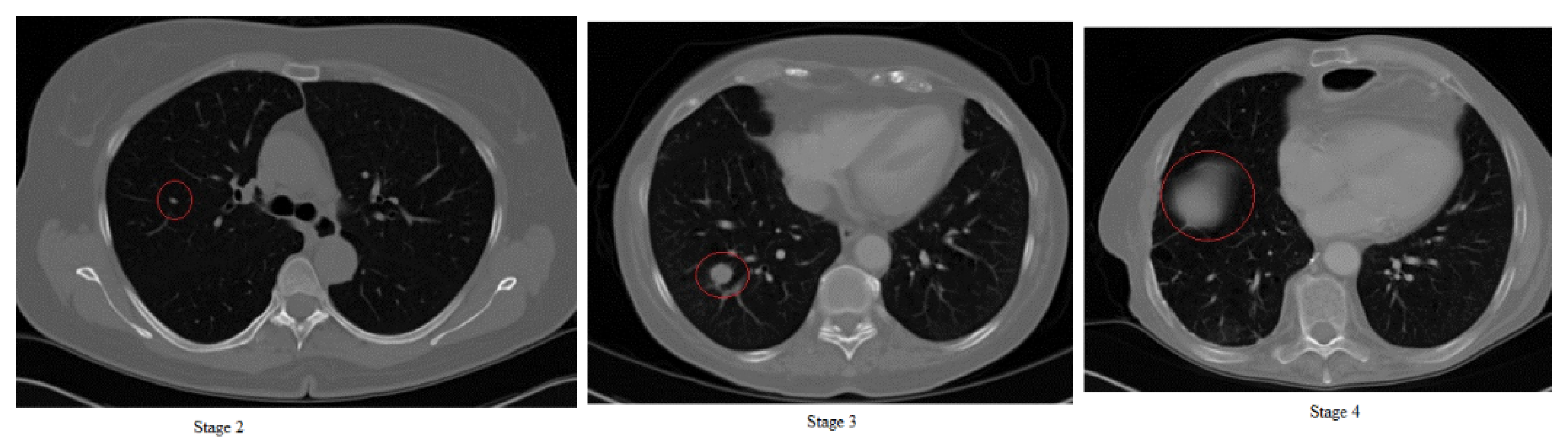 what is pericarditis in dogs