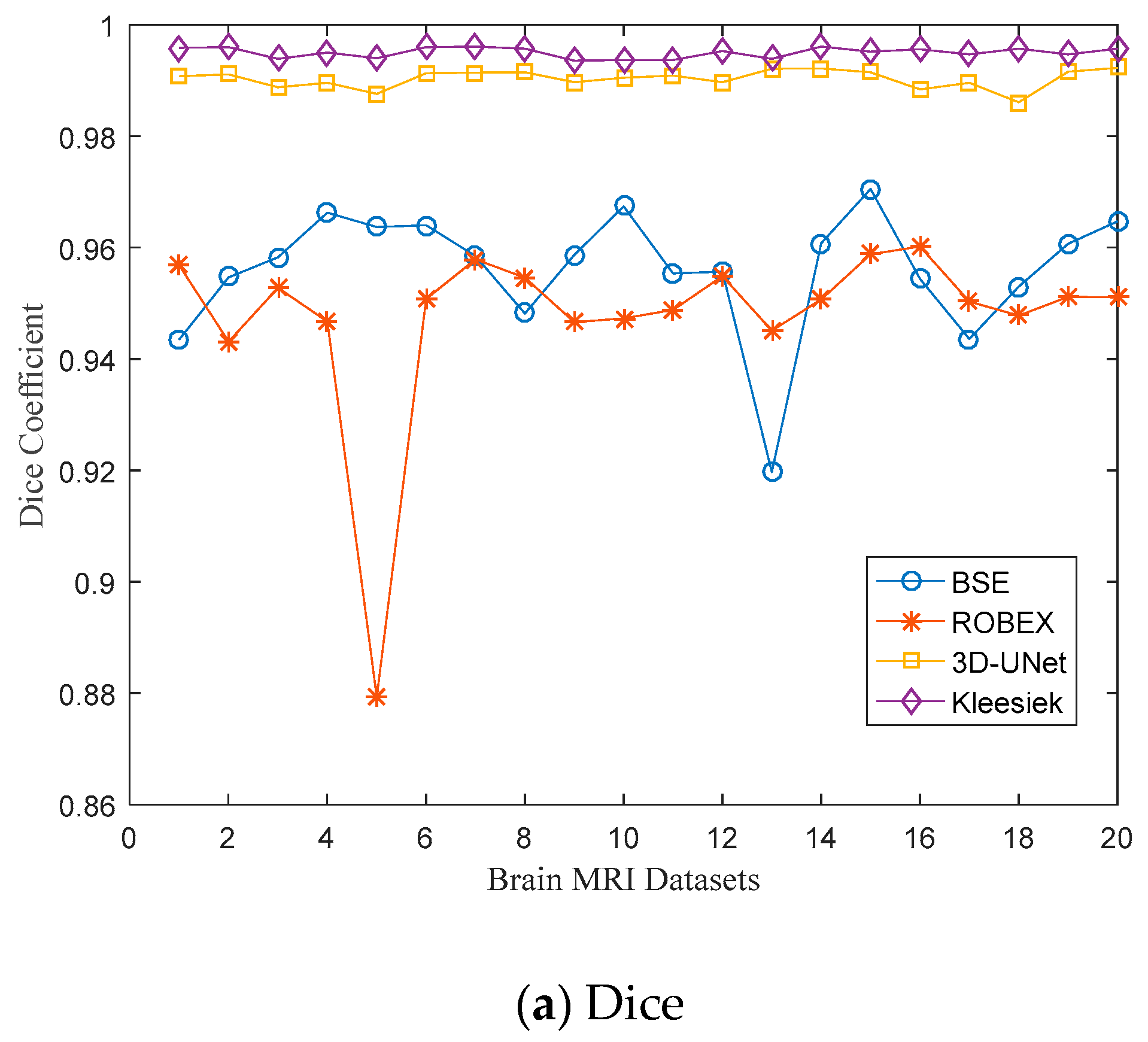 Dice comparison of 3D-UNet with BSE, ROBEX and Kleesiek's method on a