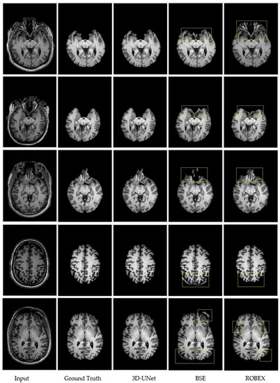 Frontiers  Automated Skull Stripping in Mouse Functional Magnetic  Resonance Imaging Analysis Using 3D U-Net