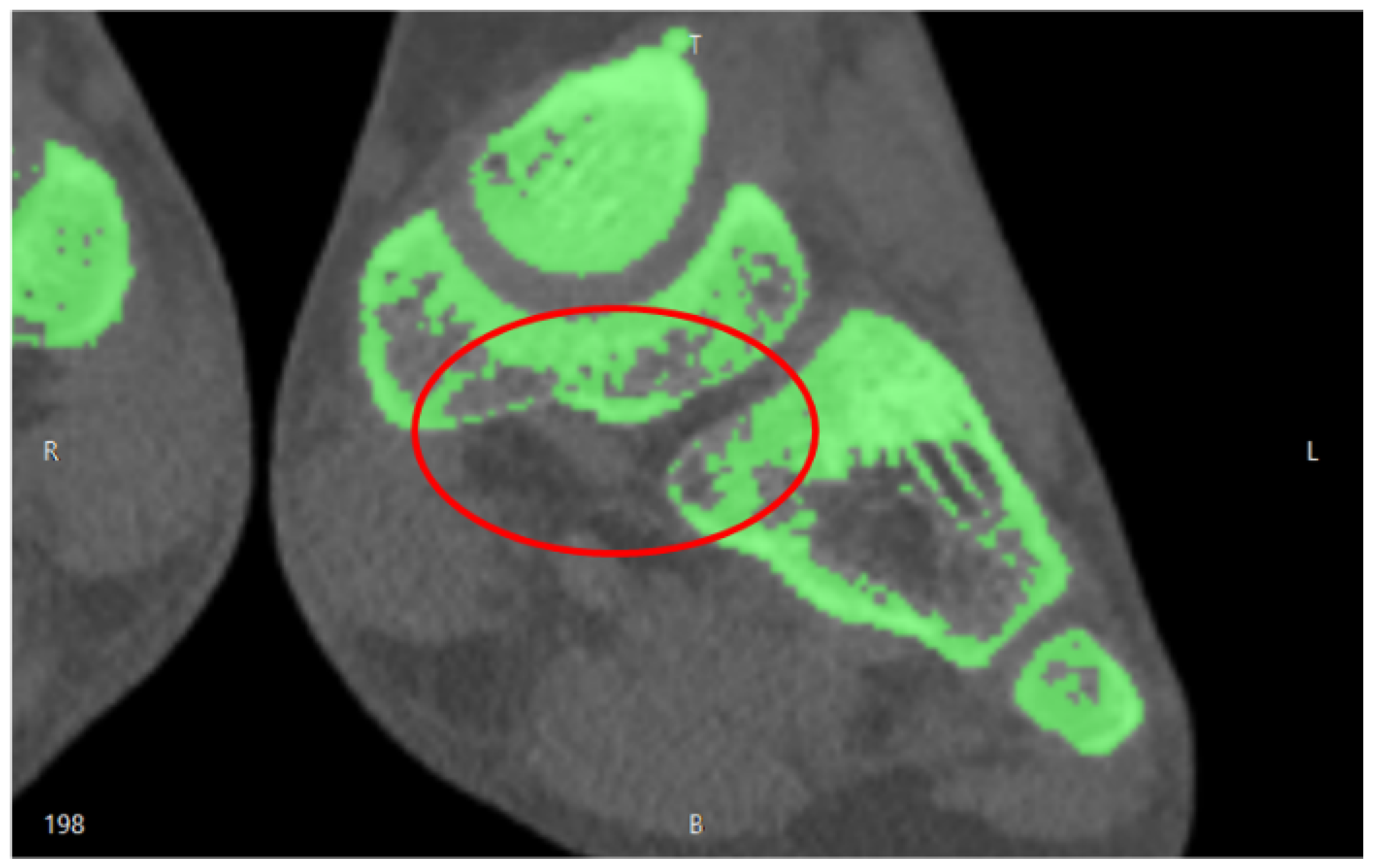 Applsci 09 00708 g005 Applsci 09 00708 g005