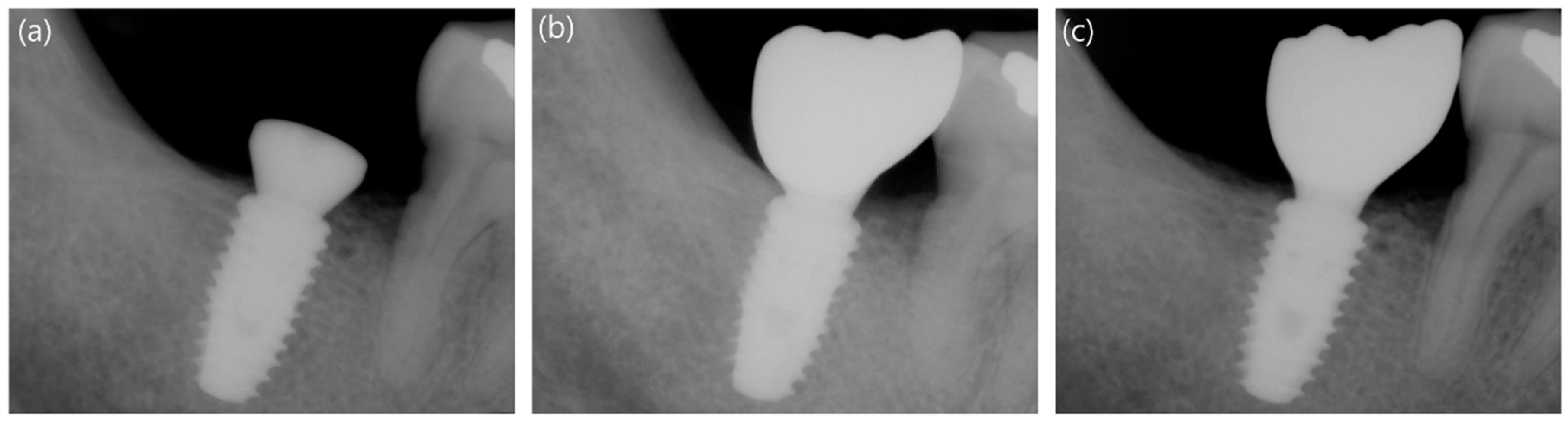 Applsci 09 01282 g004 Applsci 09 01282 g004