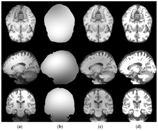 Applied Sciences | Free Full-Text | A Robust Brain MRI Segmentation and ...
