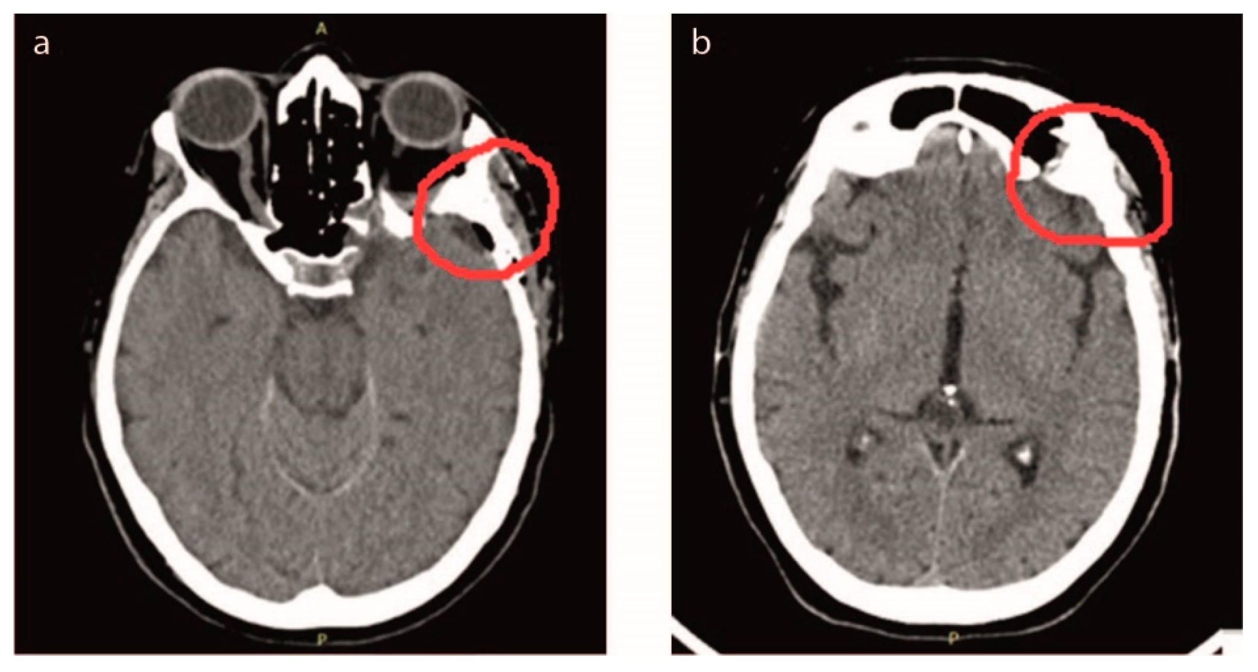 Applsci 09 01469 g004 Applsci 09 01469 g004