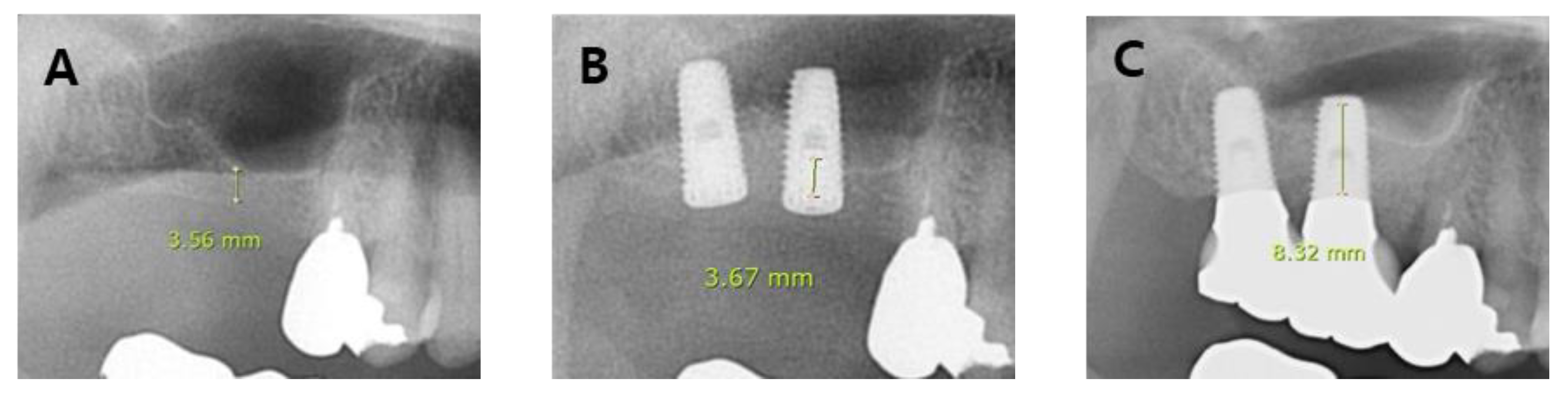 Applsci 09 01514 g004 550