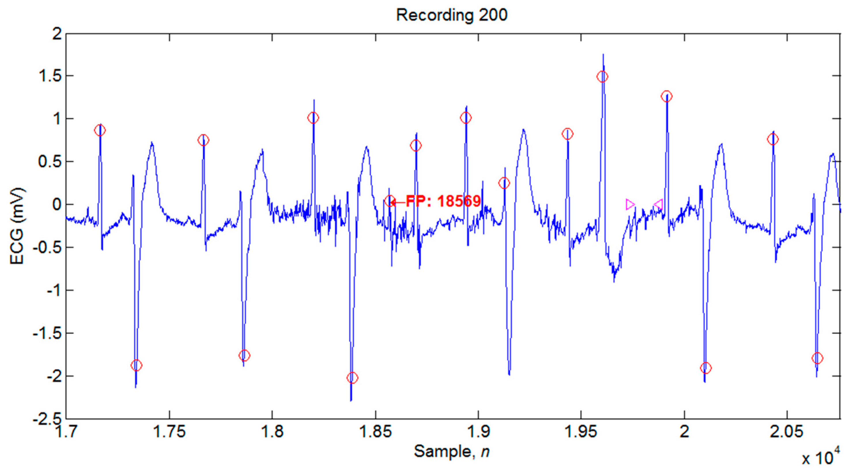 Applsci 09 02142 g012 Applsci 09 02142 g012