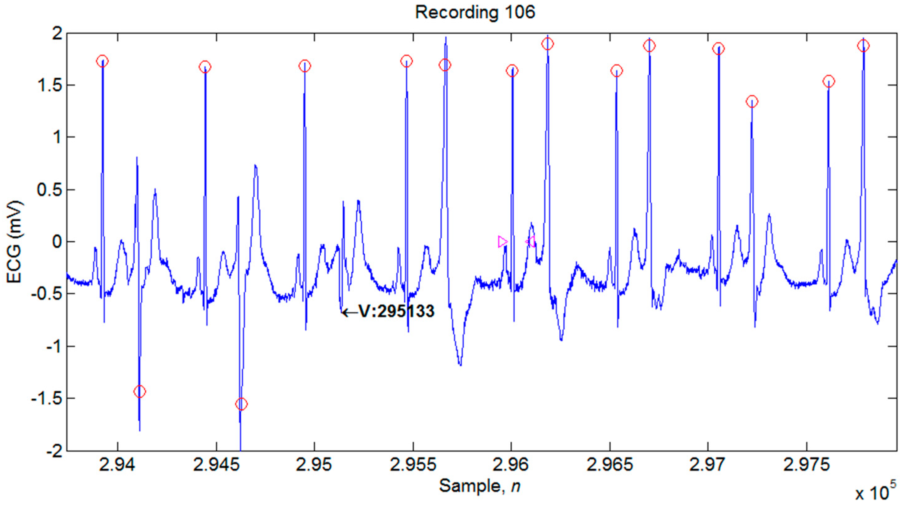 Applsci 09 02142 g013 Applsci 09 02142 g013