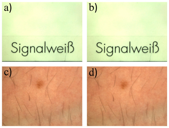 Non-Contact Dermatoscope with Ultra-Bright Light Source and