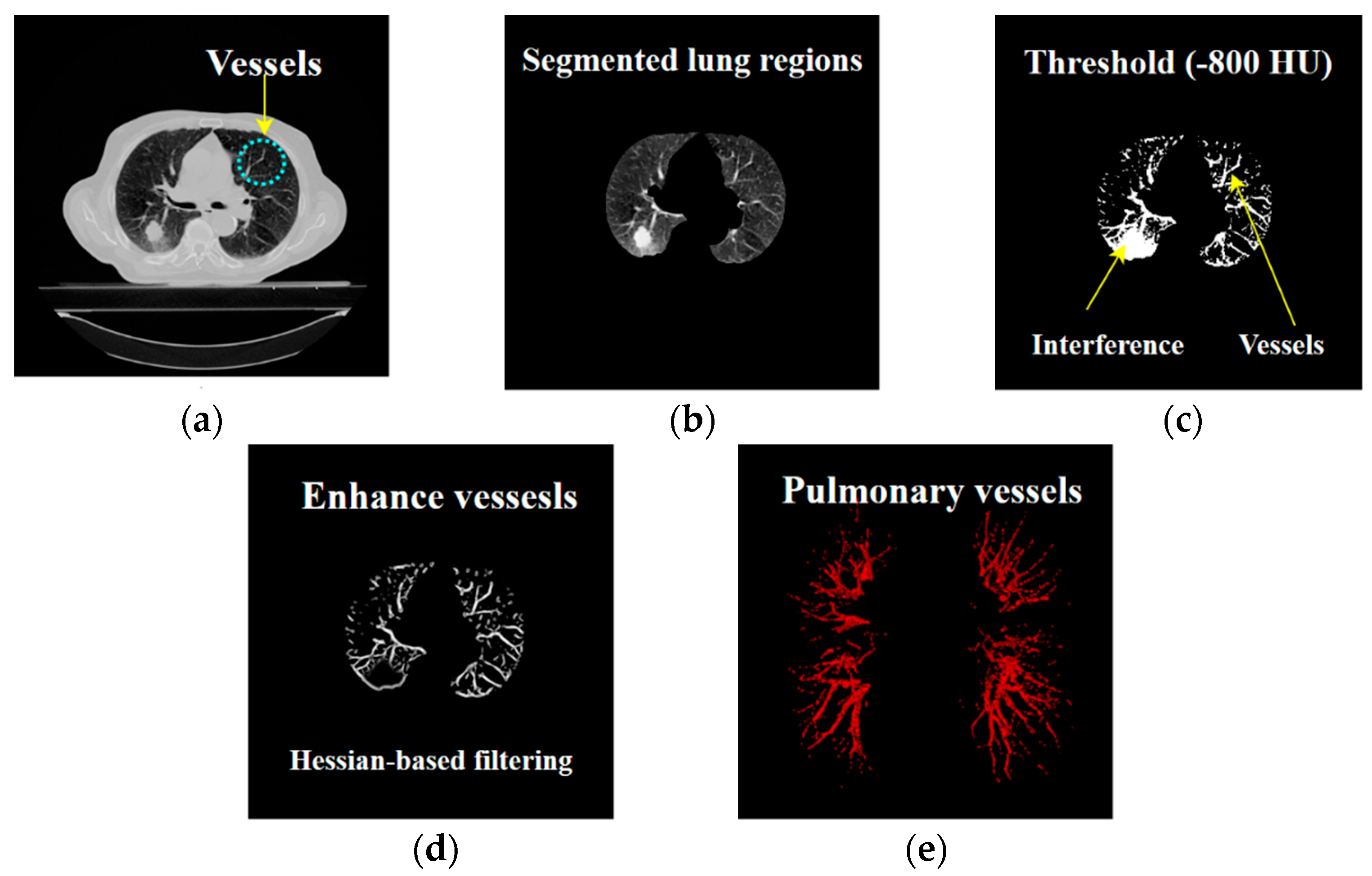 Applsci 09 02329 g006