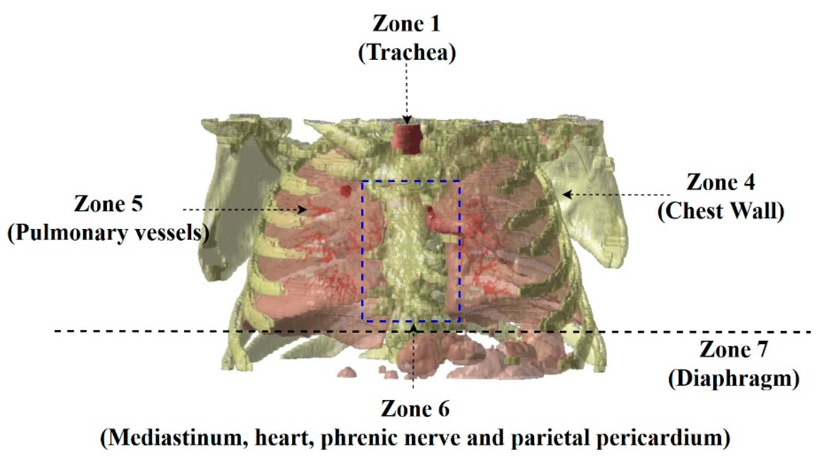 Applsci 09 02329 g011