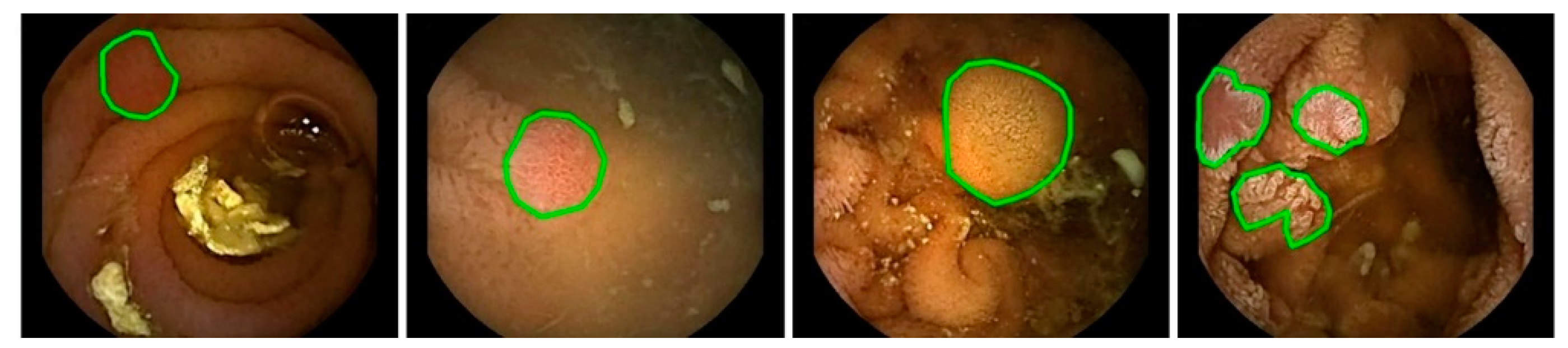 Applsci 09 02404 g002