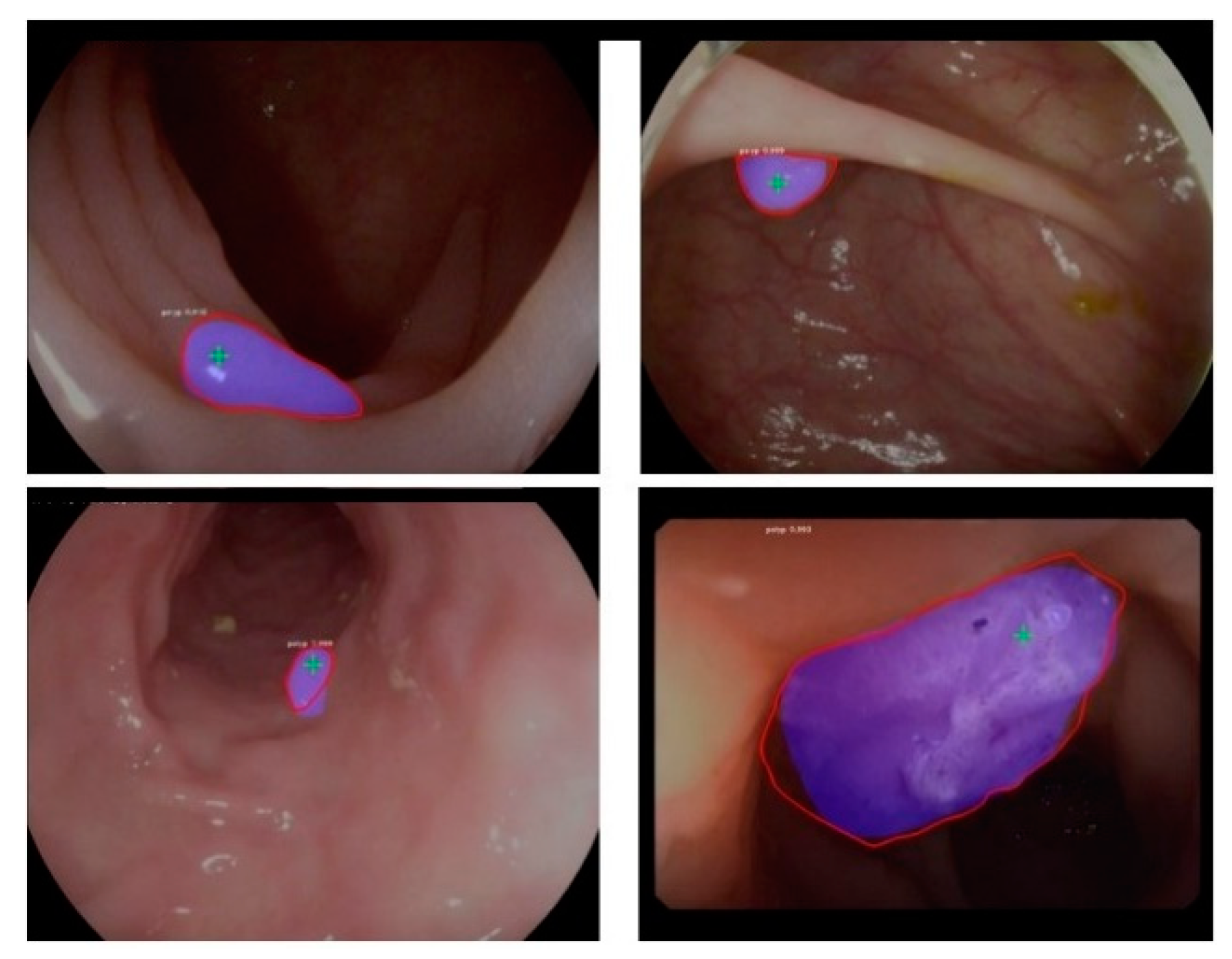 Applsci 09 02404 g005