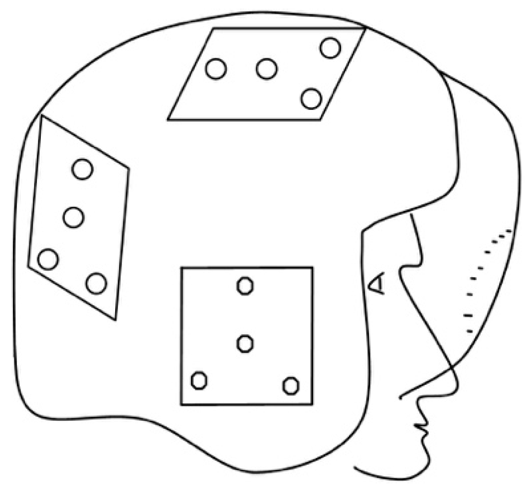 Applsci 09 02656 g014 550