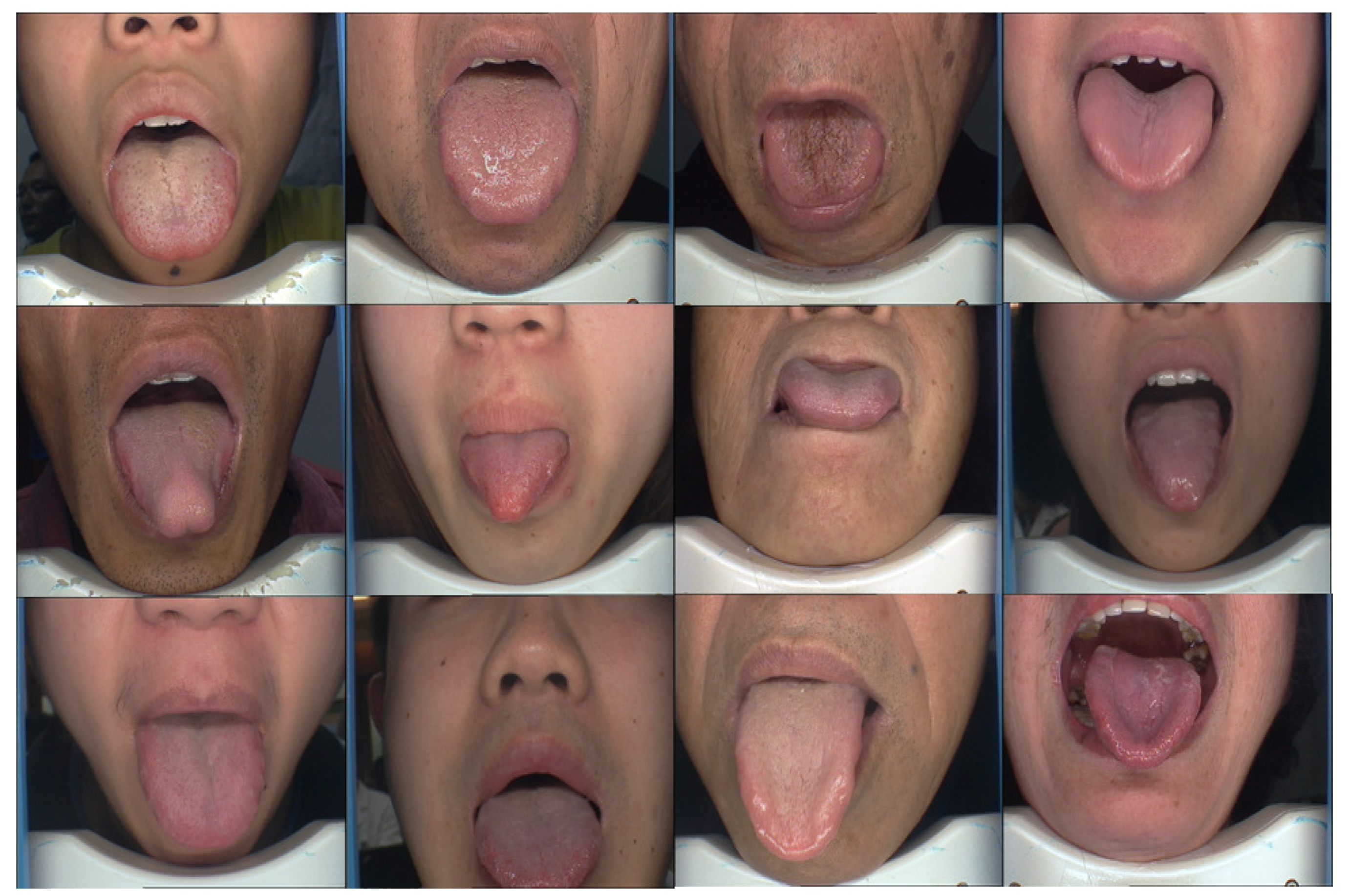 Of tongue in middle split Why Your