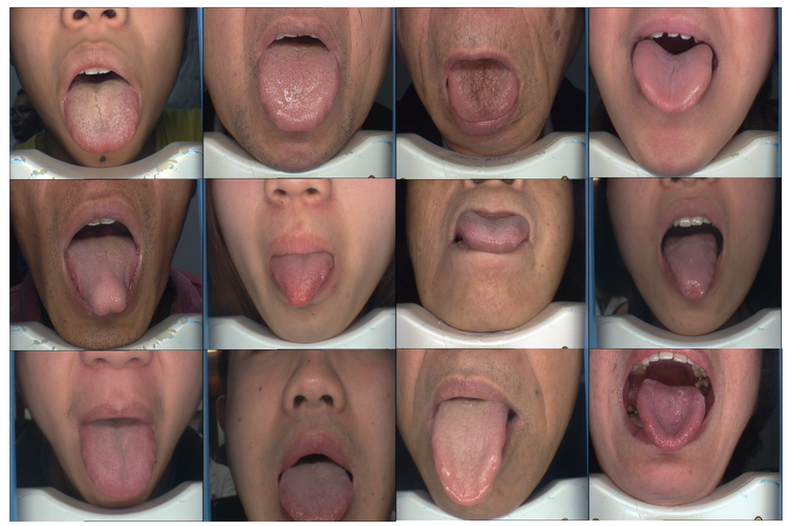 Applied Sciences Free Full Text Tonguenet A Precise And Fast Tongue Segmentation System Using U Net With A Morphological Processing Layer Html