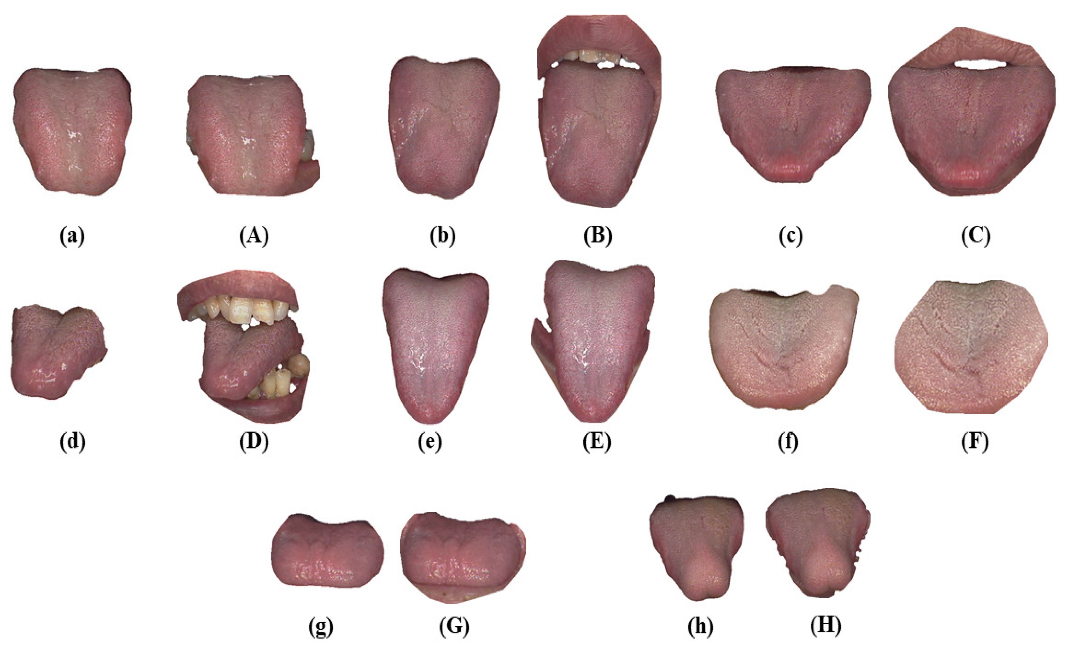 Tcm Tongue Diagnosis Chart