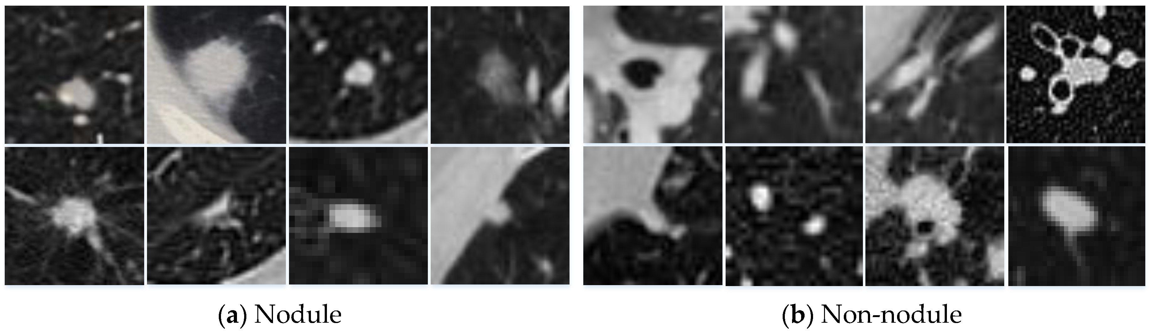 Multi-Scale Heterogeneous 3D CNN for False-Positive