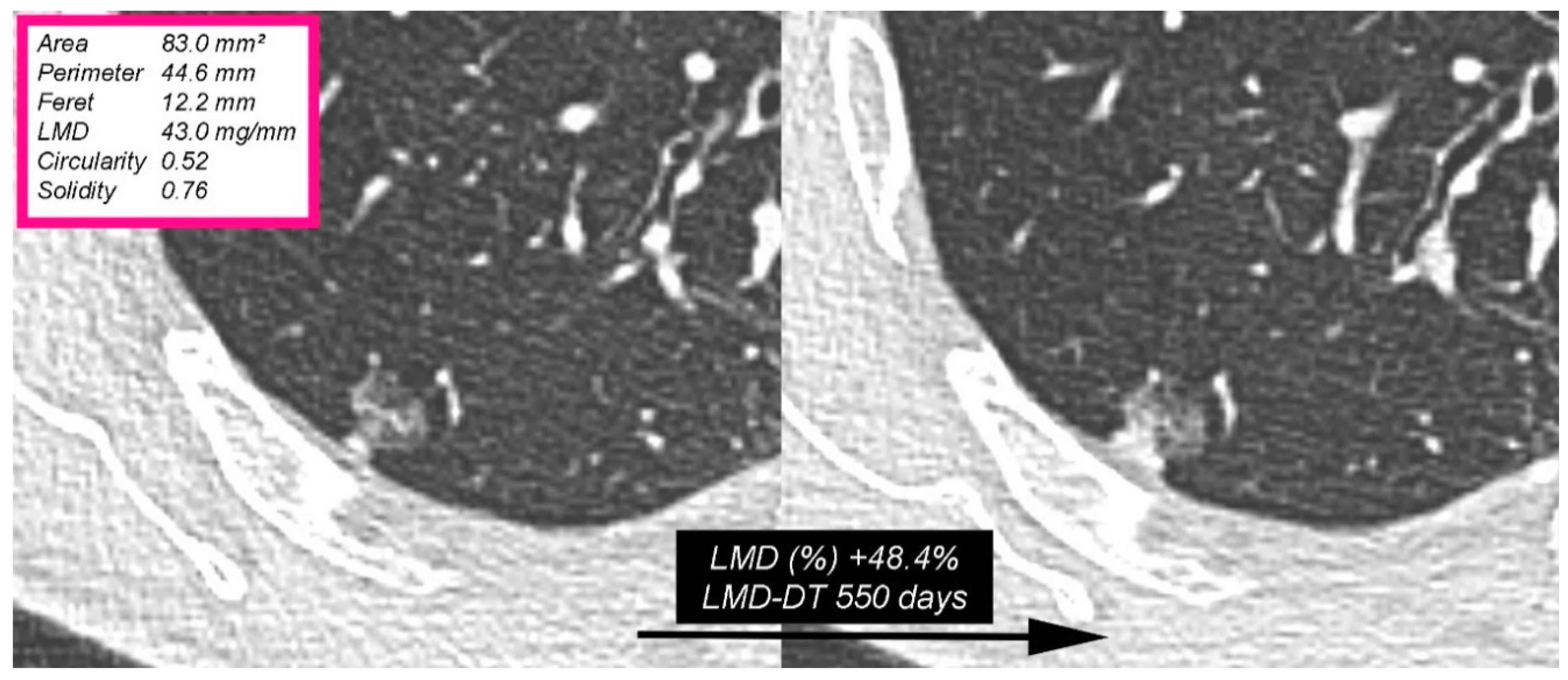 Applsci 09 03428 g006 Applsci 09 03428 g006