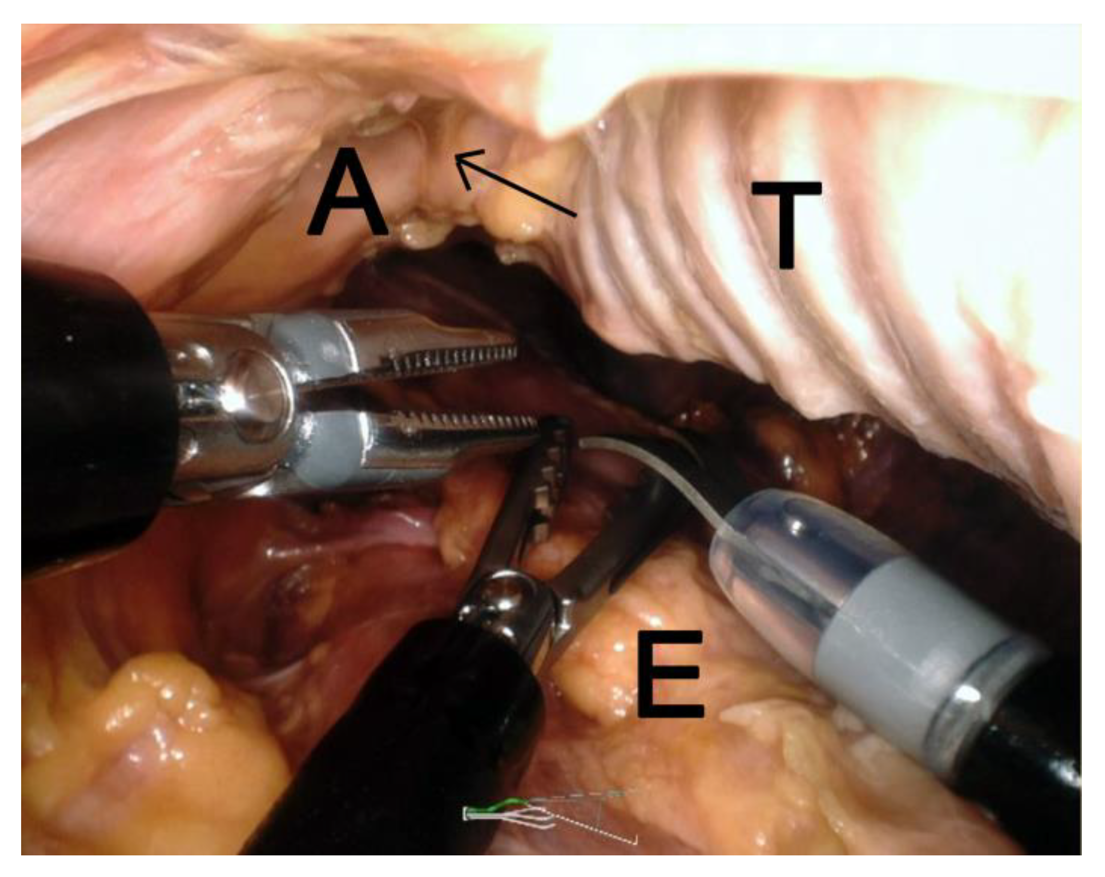 Applsci 09 03572 g004